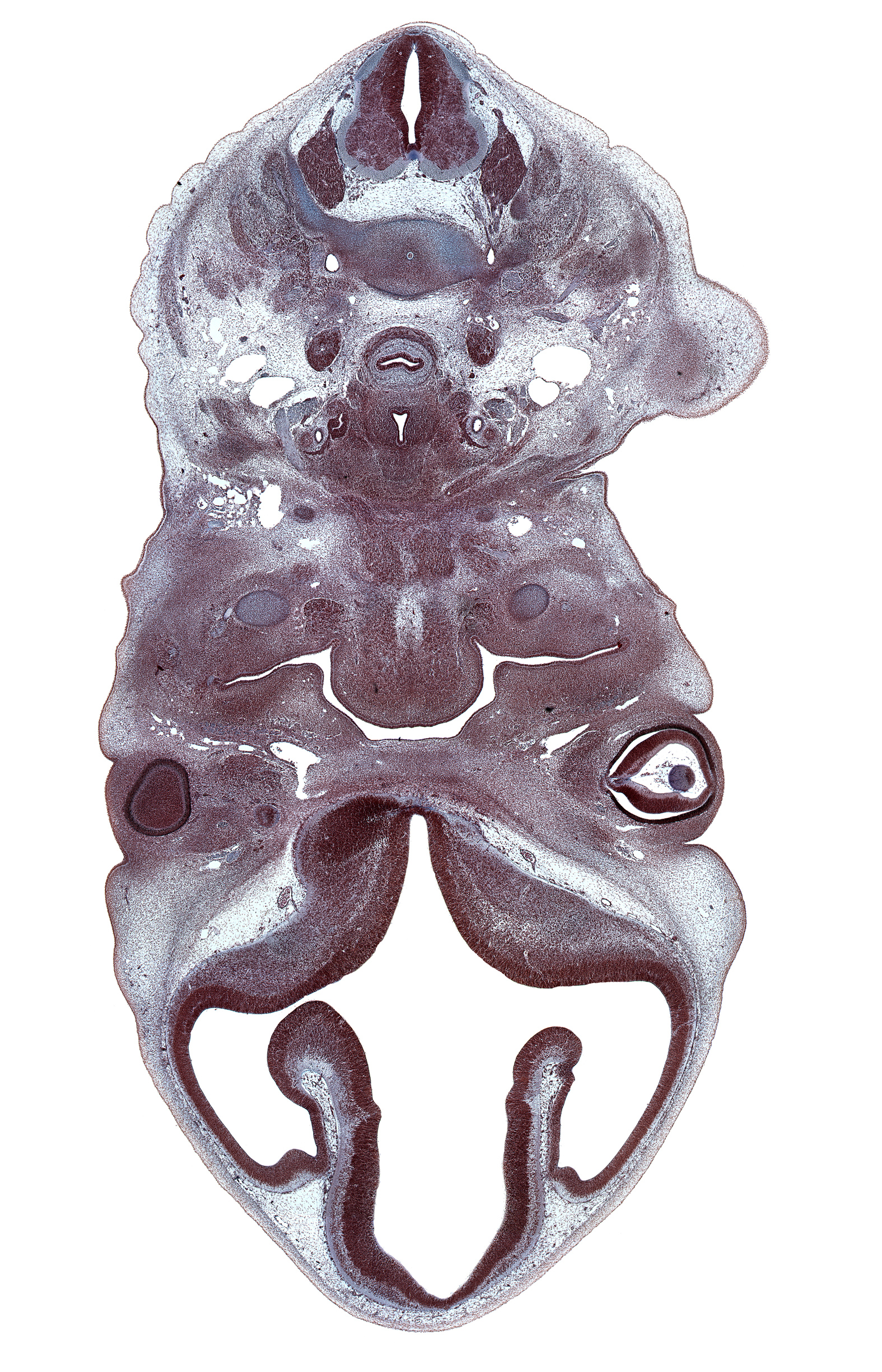 C-4 / C-5 intervertebral disc, C-5 ventral primary ramus, C-6 spinal ganglion, C-6 spinal nerve, anterior digastric muscle blastema, centrum of C-5 vertebra, corpus striatum, geniohyoid muscle blastema, hippocampus, junction of neural retina and optic nerve (CN II), laryngeal condensation, laryngeal pharynx, left common carotid artery, lower eyelid, maxillary venous plexus, middle cerebral artery, mylohyoid muscle blastema, optic nerve (CN II), palatine shelf, right common carotid artery, roof plate of diencephalon, semispinalis capitis muscle, semispinalis cervicis muscle, subarachnoid space, superior ophthalmic venous plexus, superior parathyroid gland, trapezius muscle, vagus nerve (CN X)