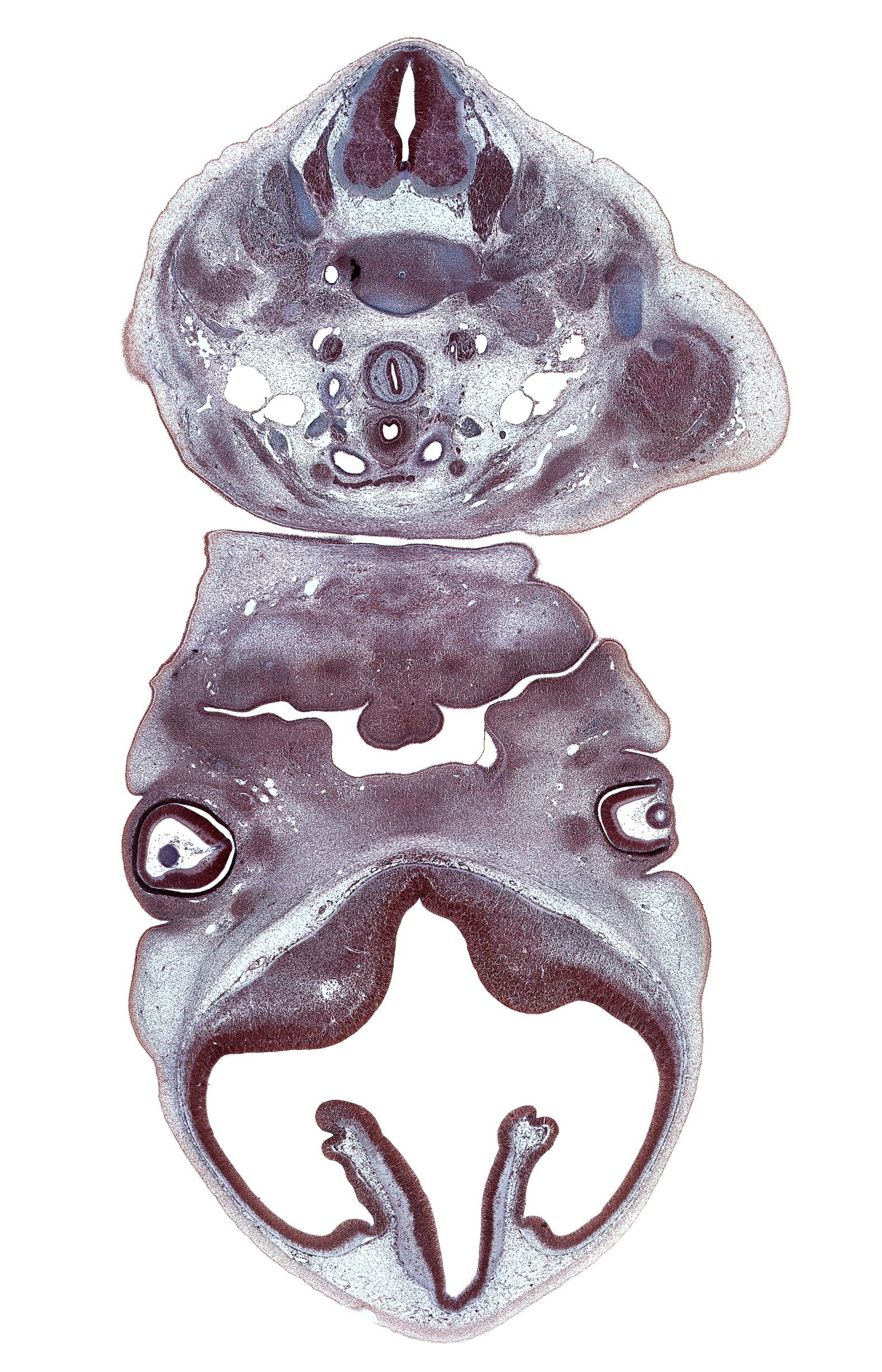 C-5 / C-6 intervertebral disc, C-7 spinal ganglion, angle of mouth, body of tongue, brachiocephalic artery, central canal, centrum of C-6 vertebra, cerebral vesicle (telencephalon), cornea, corpus striatum, deltoid muscle, dorsal root(s), inferior parathyroid gland, intraretinal space (optic vesicle cavity), isthmus of thyroid gland, lateral ventricle, left common carotid artery, lower eyelid, mandibular prominence of pharyngeal arch 1, maxillary prominence of pharyngeal arch 1, neural arch, neural layer of retina, optic cup cavity, oronasal membrane, phrenic nerve, pigmented layer of retina, scapula, sternocleidomastoid muscle, strap muscles of neck, subarachnoid space, trapezius muscle, upper eyelid, upper trunk of brachial plexus (C-5, C-6), vagus nerve (CN X), vascular plexus, ventricular eminence(s)