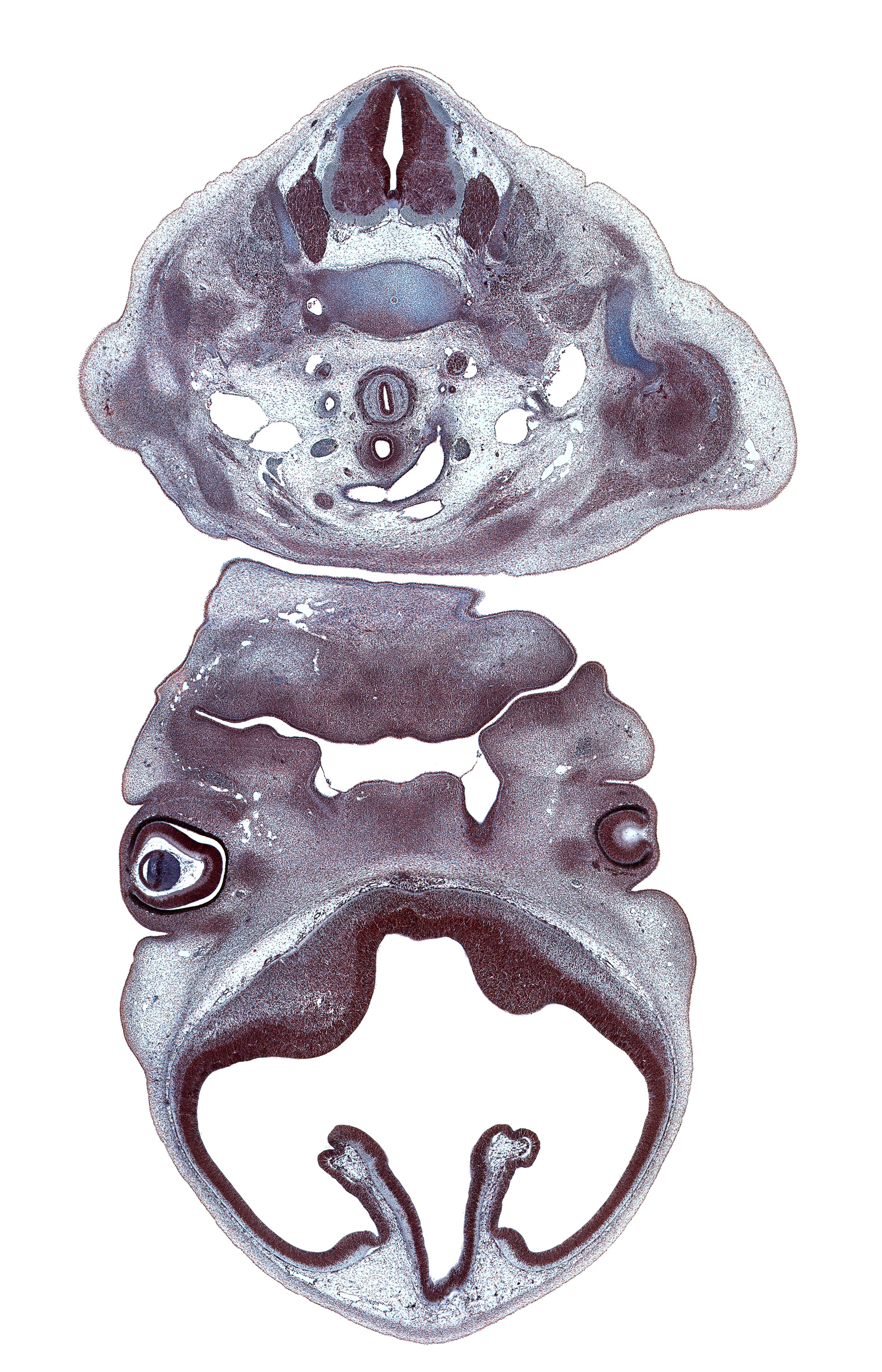 C-5 / C-6 intervertebral disc, C-7 spinal ganglion, C-7 spinal nerve, anterior scalene muscle, arch of aorta, blastema of extrinsic ocular muscle, central canal, centrum of C-6 vertebra, cephalic edge of pericardial cavity, cephalic edge of scapula, choroid fissure, choroid plexus, clavicle, cornea, esophagus muscularis, intermediate zone, lateral ventricle, left subclavian artery, left vagus nerve (CN X), lens cavity, marginal zone, maxillary venous plexus, middle scalene muscle, middle trunk of brachial plexus (C-7), nasal cavity (nasal sac), optic cup cavity, oral cavity, oronasal membrane, pectoralis major muscle, roof plate of diencephalon, scapula, ventricular eminence(s), ventricular zone