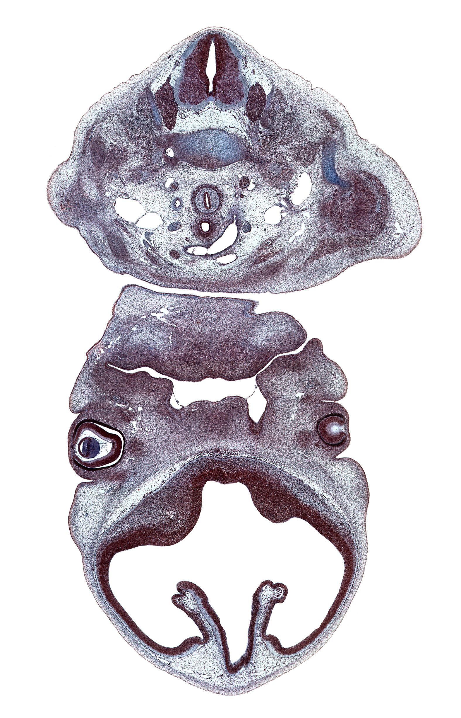 C-6 / C-7 intervertebral disc, C-7 spinal ganglion, C-7 spinal nerve, alar plate(s), anterior scalene muscle, arch of aorta, basal plate, cephalic edge of upper limb, cerebral vesicle (telencephalon), cornea, corpus striatum, edge of retina, floor plate, hippocampus, interventricular foramen, lateral ventricle, left vagus nerve (CN X), lens, maxillary venous plexus, middle trunk of brachial plexus (C-7), origin of left subclavian artery, pericardial cavity, phrenic nerve, right subclavian artery, right vagus nerve (CN X), roof of diencephalon, roof plate, subarachnoid space, sulcus limitans, ventricular eminence(s), vertebral artery