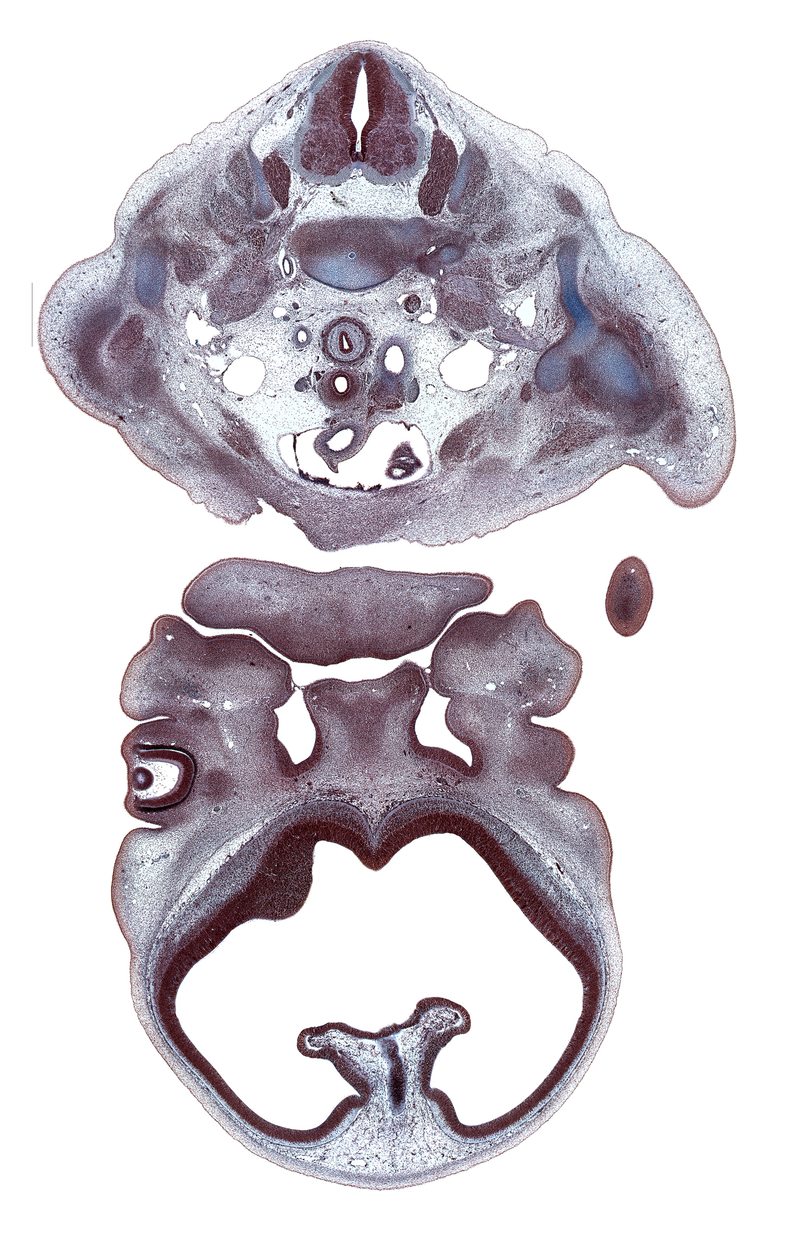 C-6 / C-7 intervertebral disc, C-7 spinal ganglion, ascending aorta, centrum of C-6 vertebra, cephalic edge of left atrium, choroid fissure, choroid plexus, clavicle, descending aorta, dorsal fasciculus, dorsal root(s), glenohumeral joint, head of humerus, hippocampus, maxillary prominence of pharyngeal arch 1, median mandibular groove, middle trunk of brachial plexus (C-7), nasal cavity (nasal sac), nasal disc (olfactory placode), pericardial cavity, phrenic nerve, precardinal vein (internal jugular vein), upper limb, upper trunk of brachial plexus (C-5, C-6), ventral root