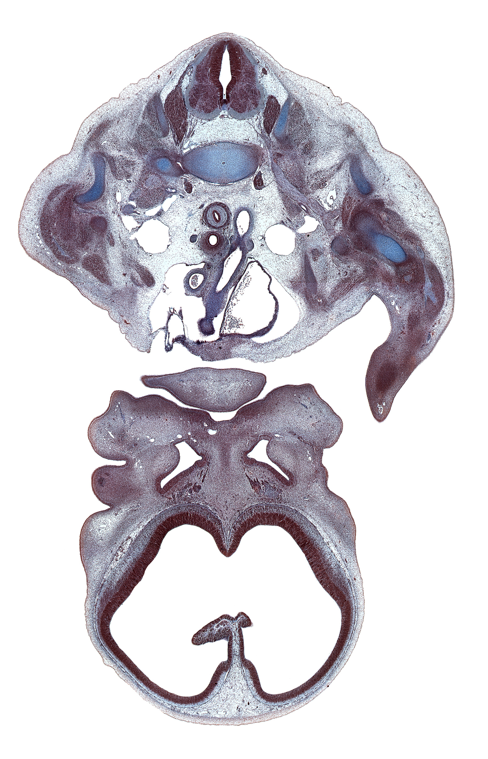 C-7 / T-1 intervertebral disc, C-8 spinal ganglion, C-8 spinal nerve, anterior scalene muscle, artifact(s), ascending aorta, centrum of C-7 vertebra, cephalic edge of rib 1, chin, ductus arteriosus, interventricular foramen, lamina terminalis, lateral ventricle, left atrium, left subclavian artery, lower trunk of brachial plexus (C-8, T-1), medial edge of eye, nasolacrimal duct, neural arch, olfactory filia (CN I), oral cavity, osteogenic layer, precardinal vein (internal jugular vein), pulmonary trunk, subarachnoid space, sympathetic trunk, vomeronasal organ