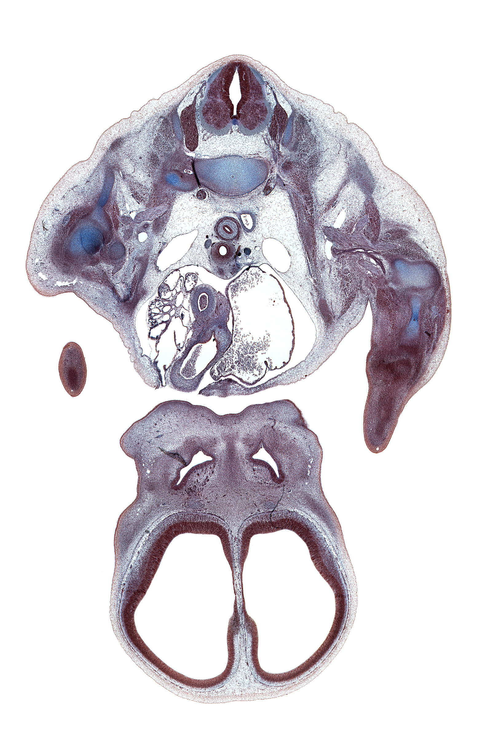 T-1 spinal ganglion, alar plate(s), artifact(s), ascending aorta, basal plate, blastemata of extensor muscle(s), centrum of T-1 vertebra, cerebral vesicle (telencephalon), glenohumeral joint, hand plate, head of humerus, hippocampus, humerus, infundibulum of right ventricle, lateral ventricle, nasal cavity (nasal sac), nasal septal cartilage condensation, primary palate, radiohumeral joint, radius, sulcus limitans, superior vena cava, vascular plexus