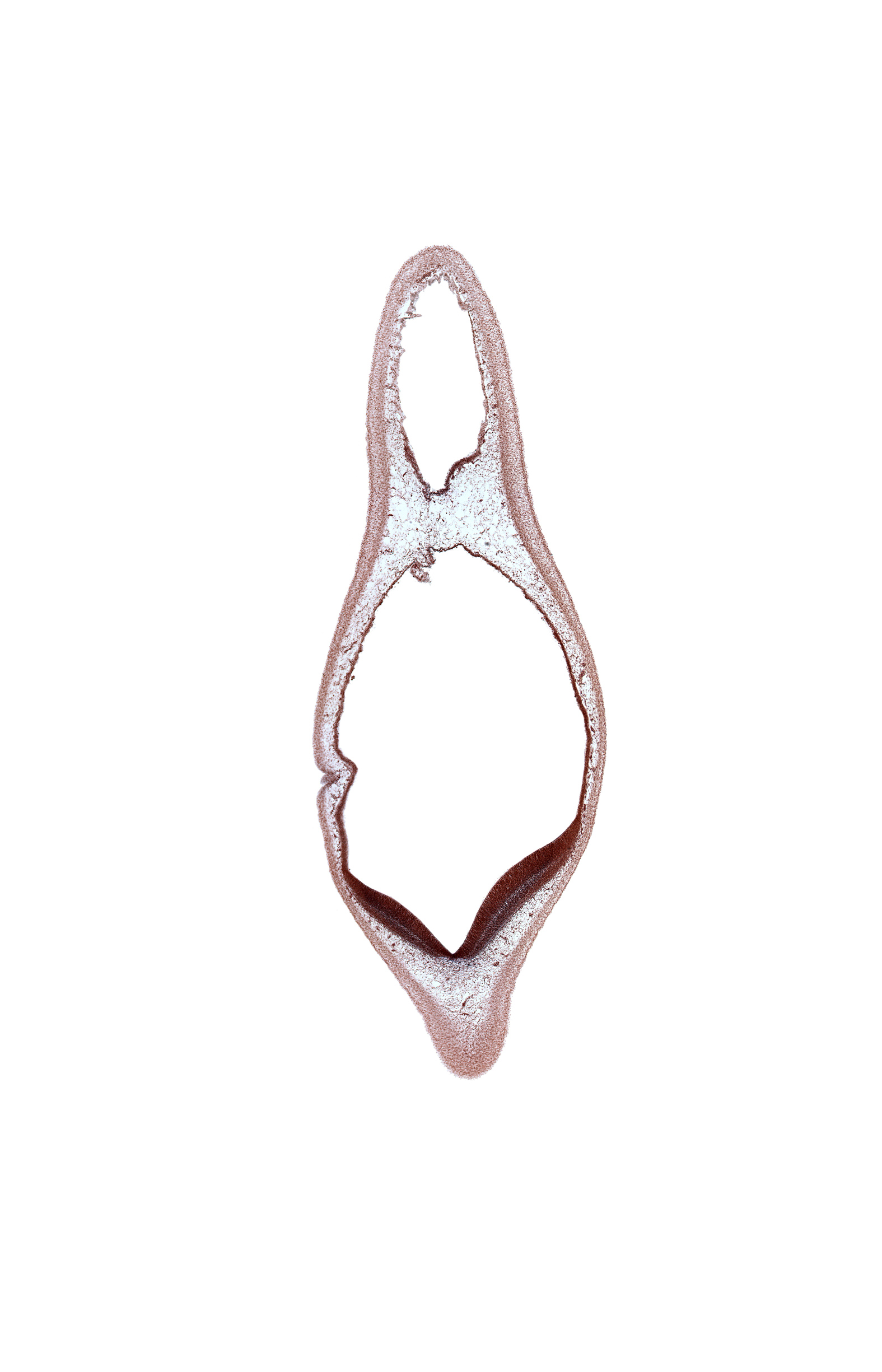 alar plate of metencephalon, diverticulum of rhombencoel (fourth ventricle), rhombencoel (fourth ventricle), roof of rhombencoel (fourth ventricle), subarachnoid space, tangentially cut surface ectoderm, vascular plexus