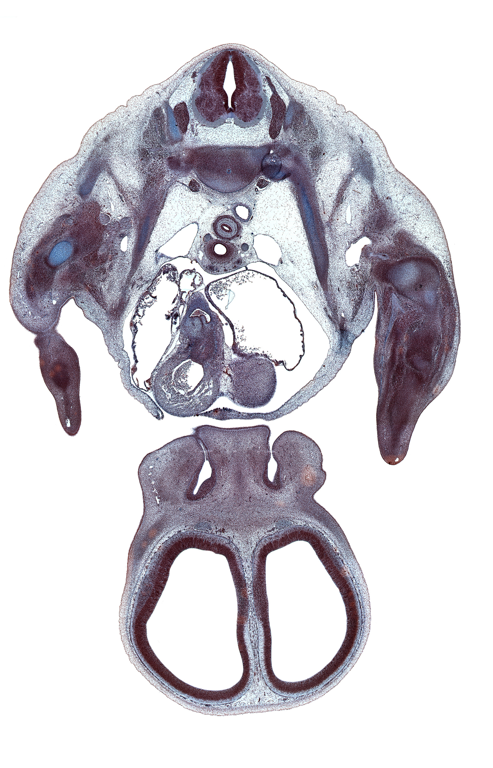 T-1 / T-2 intervertebral disc, T-2 spinal ganglion, aortic semilunar valve, artifact(s), centrum of T-1 vertebra, centrum of T-2 vertebra, cephalic edge of left ventricle, cerebral vesicle (telencephalon), deltoid muscle, falx cerebri region, frontal prominence, head of radius, humerus, intermaxillary segment, lateral ventricle, left atrium, marginal vein, naris, nasal cavity (nasal sac), nasal fin, neural arch, pericardial cavity, rib 2, right atrium, scapula, serratus anterior muscle, trabecular part of right ventricle