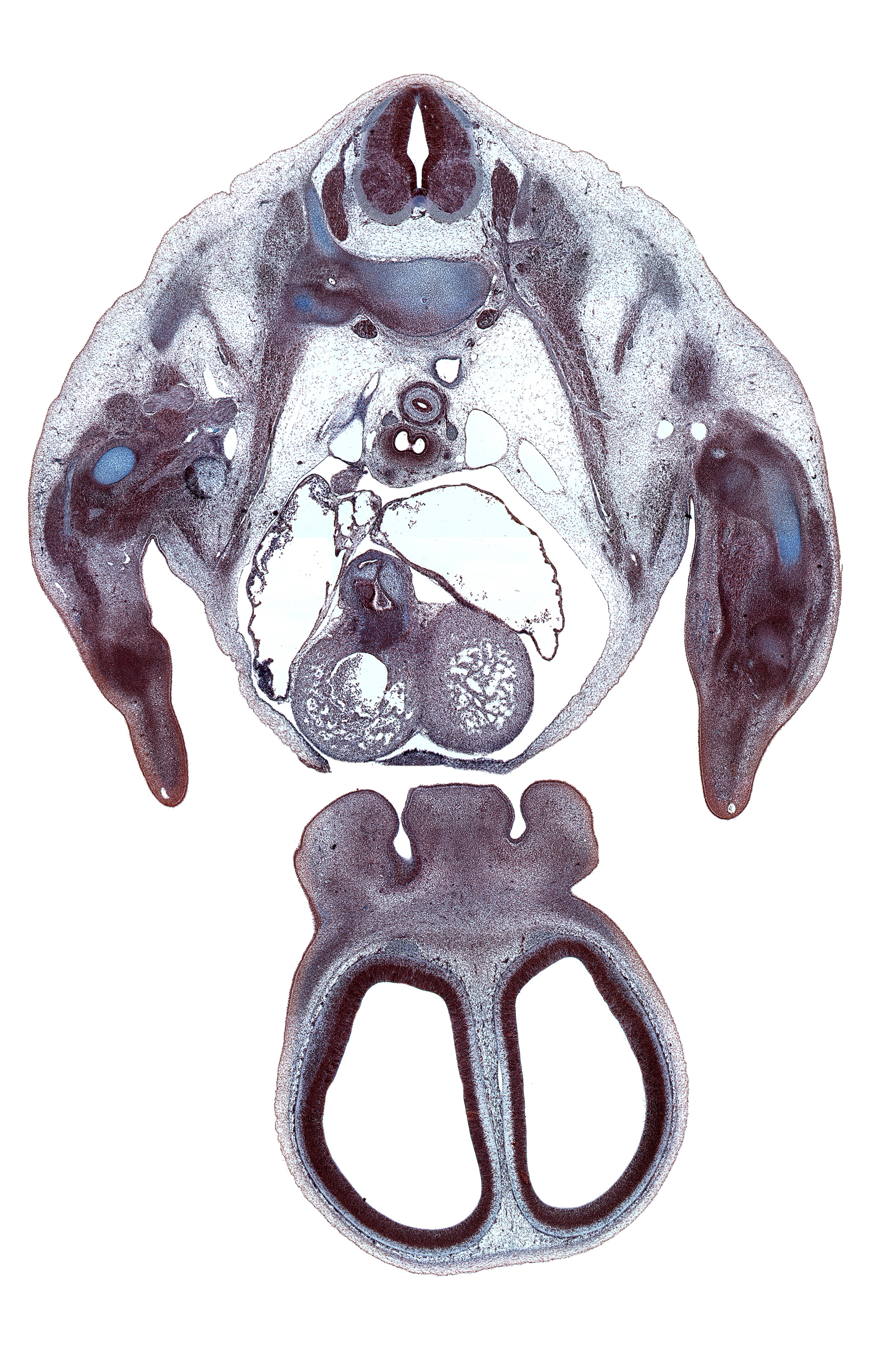 T-2 intercostal nerve, T-2 spinal ganglion, aorta, aortic semilunar valve, arch of azygos vein, cephalic edge of pleural cavity, cerebral vesicle (telencephalon), communicating ramus, dorsal horn of grey matter, esophagus, forearm region, frontal prominence, hand plate, intercostobrachial nerve, interorbital groove, lateral nasal prominence, left atrium, left ventricle, medial nasal prominence(s), naris, nasal cavity (nasal sac), olfactory bulb, phrenic nerve, precardinal vein, right atrium, right ventricle, subarachnoid space, superior vena cava, tracheal bifurcation, ventral horn of grey matter