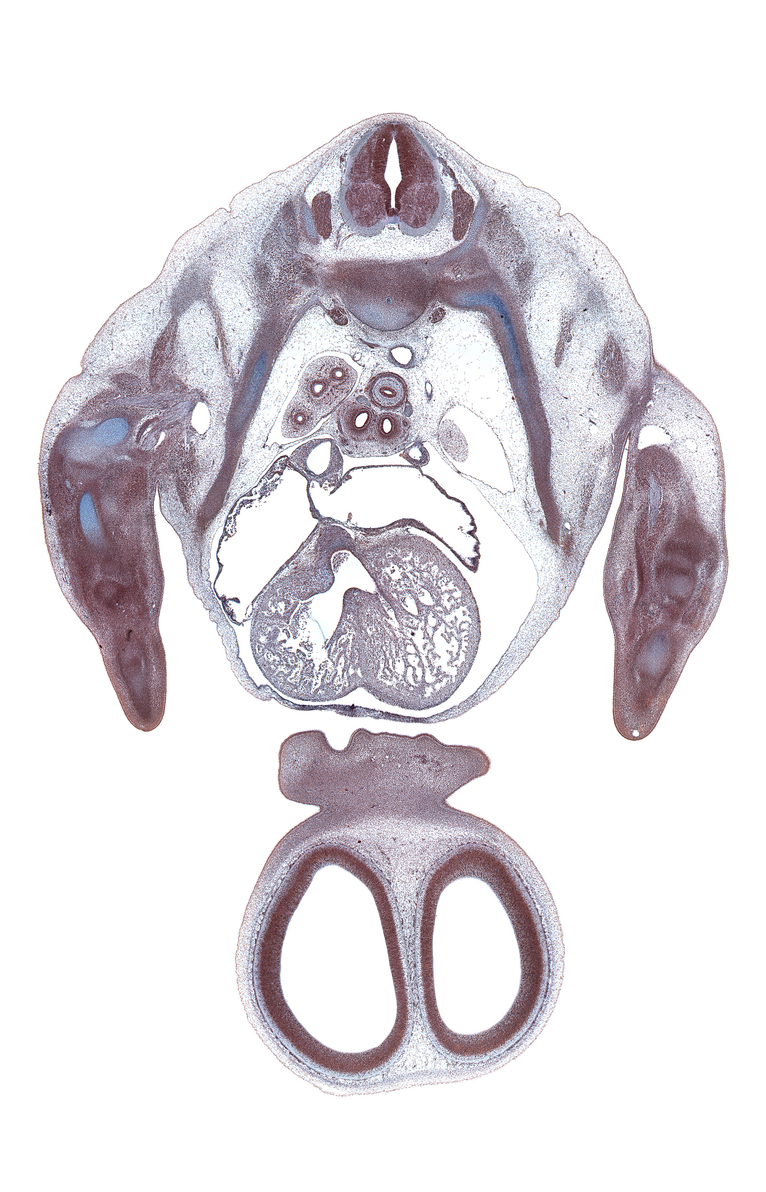 T-3 spinal ganglion, anterior interventricular sulcus, aorta, apex of left lung, central canal, cerebral vesicle (telencephalon), frontal prominence, head of rib 3, intermediate zone, interorbital ligament, interventricular foramen, junction of lateral and medial nasal prominences, junction of right atrium and superior vena cava, lateral ventricle, left primary bronchus, left ventricle, marginal vein, marginal zone, muscular interventricular septum, musculi pectinati in left atrial wall, musculi pectinati in right atrial wall, naris, osteogenic layer, pleural cavity, radius, right primary bronchus, right ventricle, sympathetic trunk, upper lobe of right lung, ventricular zone