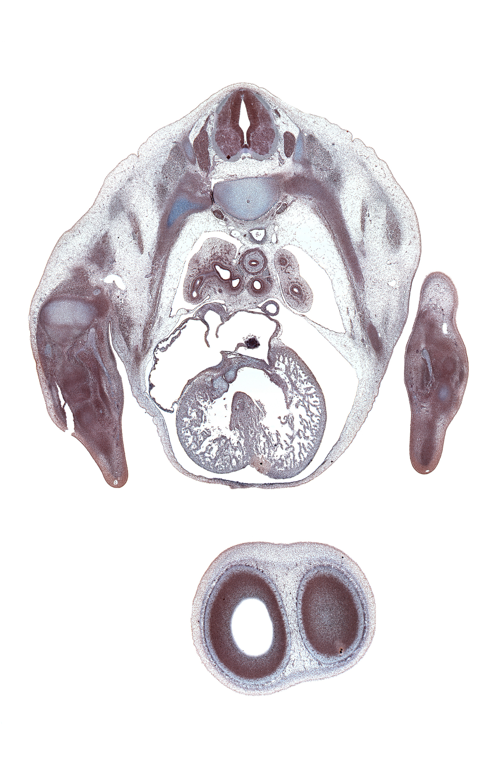 T-4 spinal ganglion, anterior interventricular groove, anterior tertiary bronchus, aorta, artifact(s), eparterial bronchus (upper secondary bronchus), intermediate zone, lateral ventricle, left venous valve, left ventricle, marginal zone, median nerve, muscular interventricular septum, neural arch, notochord, osteogenic layer, palmar side of hand plate, pleural cavity, primary interatrial septum (septum primum), rib 4, right primary bronchus, right venous valve, right ventricle, secondary interatrial foramen (foramen secundum), trapezius muscle, upper lobe of left lung, upper lobe of right lung