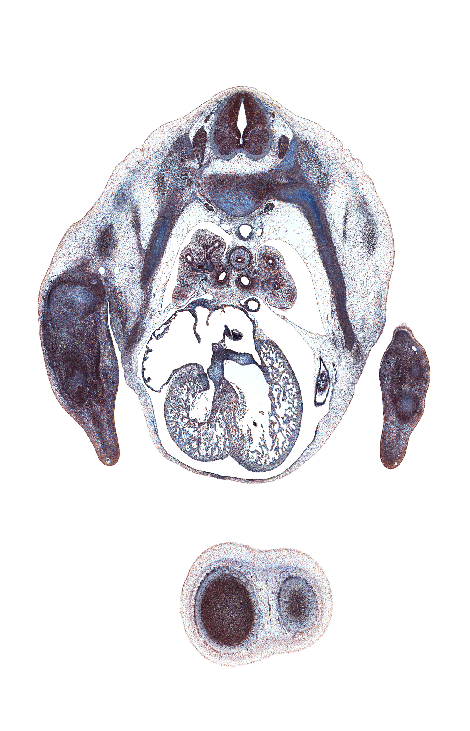 T-3 / T-4 intervertebral disc, T-4 spinal ganglion, apical tertiary bronchus, central canal, cephalic edge of left lobe of liver, cephalic edge of peritoneal cavity, horizontal fissure, left primary bronchus, marginal zone of left cerebral vesicle, middle lobe of right lung, osteogenic layer, pericardial cavity, phrenic nerve, pleural cavity, posterior tertiary bronchus, primary interatrial septum (septum primum), radial nerve, rib 4, right venous valve, secondary interatrial foramen (foramen secundum), secondary interatrial septum (septum secundum), superior hemi-azygos vein, trabecular part of left ventricle, upper lobe of left lung, vascular plexus