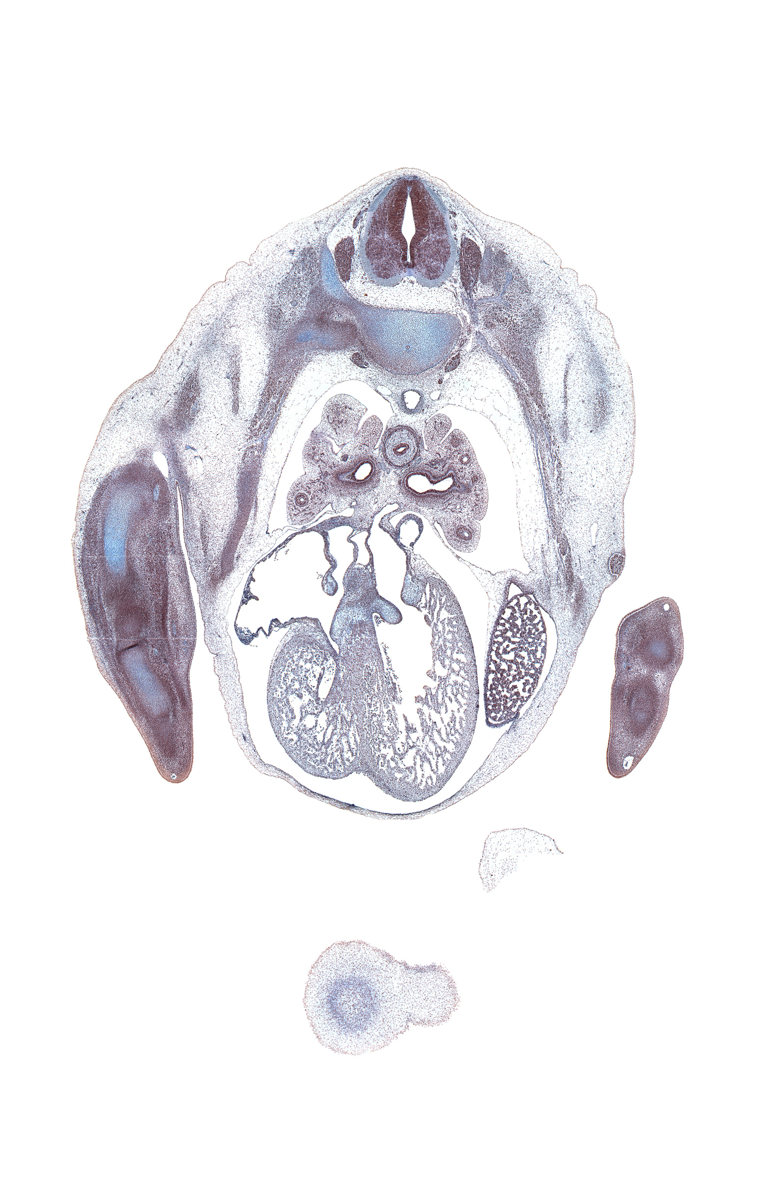 T-4 dorsal primary ramus, T-4 intercostal nerve, T-4 spinal ganglion, azygos vein, coronary sinus, edge of vascular plexus, extensor compartment of arm, flexor compartment of arm, frontal prominence, head of humerus, horizontal fissure, inferior tertiary bronchus, inferior tertiary bronchus of left lung, left atrioventricular (mitral) valve, left pulmonary vein, left ventricle, lower lobe of left lung, mammary gland, marginal vein, middle lobe of right lung, muscular part of interventricular septum, oblique fissure, phrenic nerve, primary bronchus of right lung, radius, right venous valve, right ventricle, superior tertiary bronchus of left lung, upper lobe of left lung, upper lobe of right lung, upper secondary bronchus of left lung