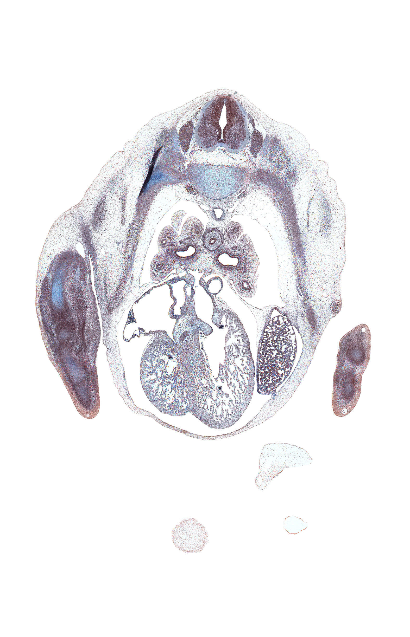 T-4 spinal ganglion, anterior interventricular sulcus, aorta, caudal edge of upper lobe of right lung, edge of frontal prominence, hand ray, horizontal fissure, humerus, left atrioventricular (mitral) valve, left lobe of liver, lower lobe of left lung, lower lobe of right lung, lower secondary bronchus, median nerve, metacarpal cartilage, middle lobe of right lung, notochord, oblique fissure, pulmonary vein(s), right atrium, right ventricle, ulnar nerve, upper lobe of left lung, upper secondary bronchus, valve of inferior vena cava