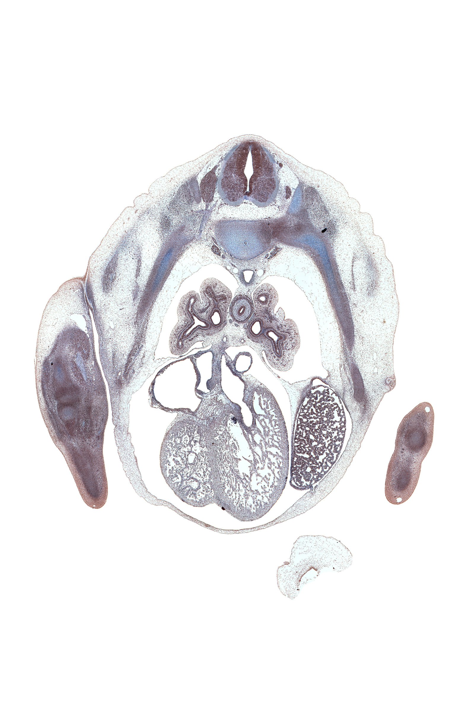 T-5 spinal ganglion, apex of heart, coronary sinus, dorsal surface of hand plate, heart prominence, inferior tertiary bronchus, lateral tertiary bronchus, latissimus dorsi muscle, left atrium, left lobe of liver, loose mesenchyme, lower lobe of left lung, lower lobe of right lung, lower secondary bronchus, mammary gland, medial tertiary bronchus, middle lobe of right lung, oblique fissure, phrenic nerve, pulmonary vein(s), rib 5, right atrium, serratus anterior muscle, upper lobe of left lung