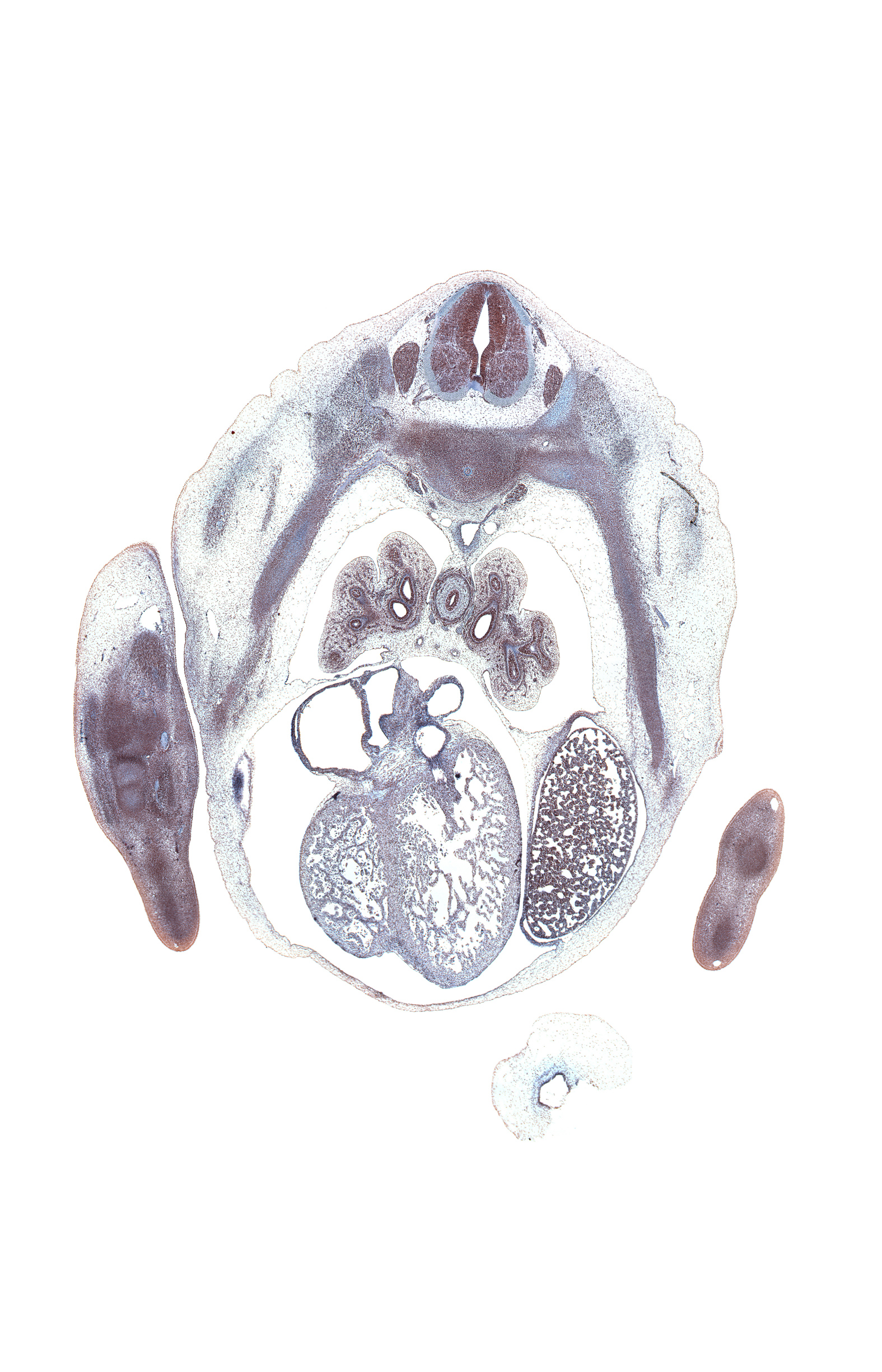 T-5 / T-6 intervertebral disc, T-5 spinal ganglion, anterior interventricular sulcus, central canal, cephalic edge of right lobe of liver, coronary sinus, dorsal horn of grey matter, elbow joint, esophageal nerve plexus, lateral horn of grey matter, left atrium, left lobe of liver, left ventricle, lower lobe of right lung, mammary gland, metacarpal cartilage, middle lobe of right lung, oblique fissure, palmar surface of hand plate, peritoneal cavity, posterior intercostal artery, pulmonary vein(s), rib 5, right atrium, right ventricle, superior tertiary bronchus, ventral horn of grey matter