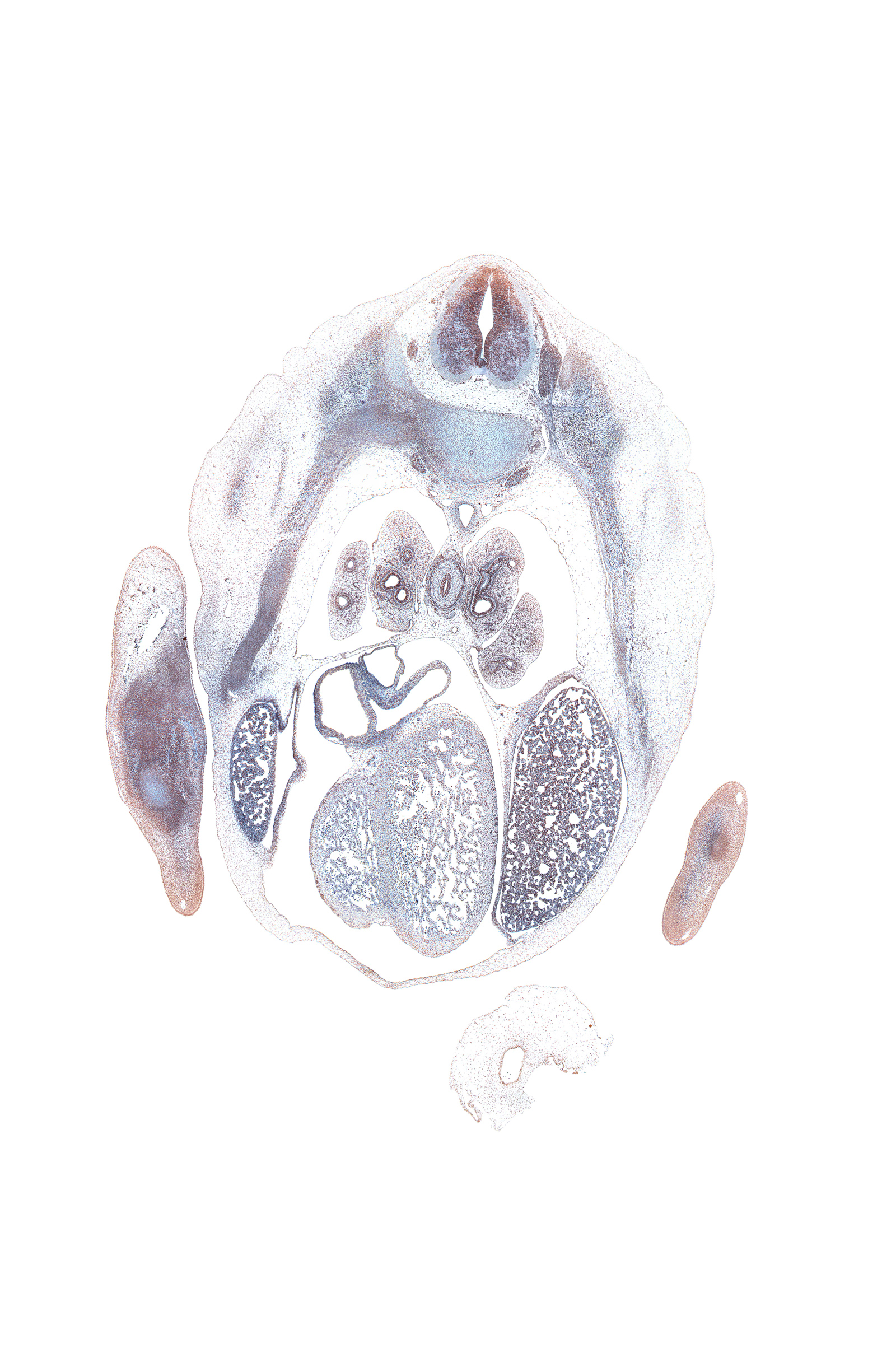 T-5 intercostal nerve, T-5 spinal ganglion, aorta, flexor tendons in forearm, iliocostalis muscle, inferior vena cava, left lobe of liver, longissimus muscle, lower lobe of left lung, lower lobe of right lung, medial tertiary bronchus, middle lobe of right lung, oblique fissure, palmar side of hand plate, pericardial cavity, pleuropericardial membrane, pleuroperitoneal membrane, posterior basal tertiary bronchus, right atrium, right lobe of liver, semispinalis muscle, sympathetic trunk, upper lobe of left lung