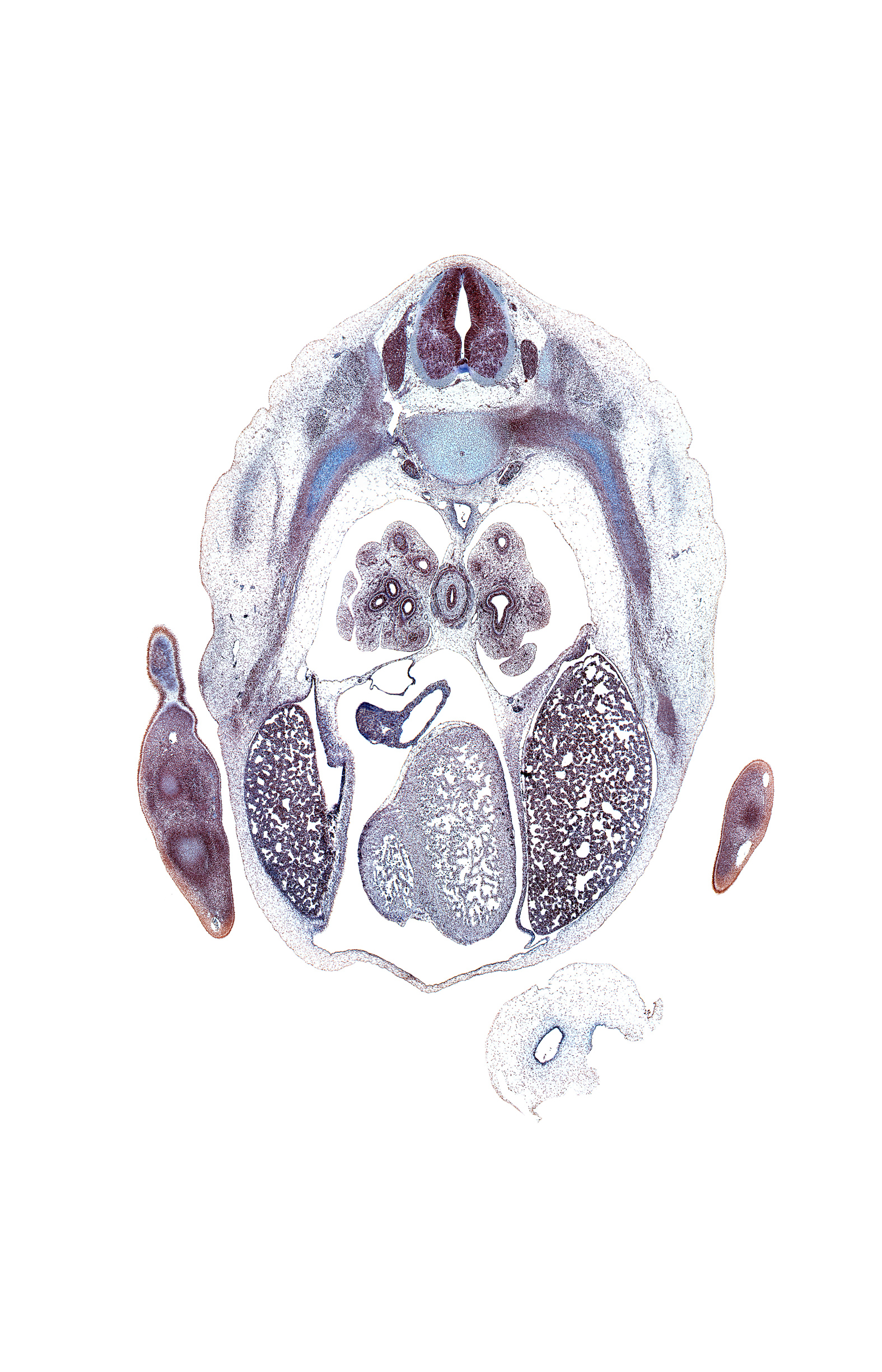 T-5 spinal ganglion, anterior basal tertiary bronchus, anterior interventricular sulcus, anterior medial basal tertiary bronchus, aorta, caudal edge of middle lobe of right lung, caudal edge of right atrium, caudal edge of upper lobe of left lung, cephalic edge of mesonephros, coronary sinus, hand plate, heart prominence, inferior vena cava, lateral basal tertiary bronchus, left lobe of liver, left lower pulmonary vein, left ventricle, metacarpal condensation, oblique fissure, pleuroperitoneal membrane, posterior basal tertiary bronchus, rib 6, right lobe of liver, right ventricle, subarachnoid space, sympathetic trunk