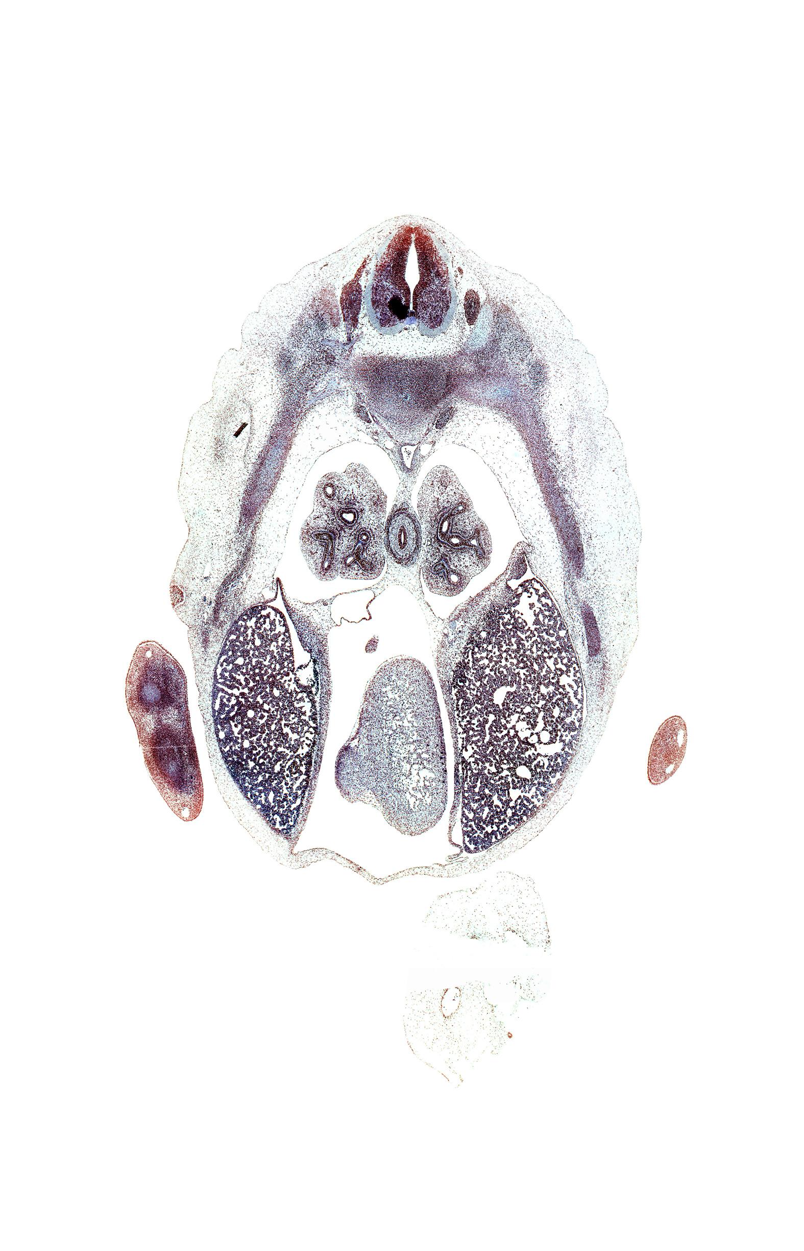 T-6 / T-7 intervertebral disc, T-6 spinal ganglion, anterior interventricular sulcus, aorta, azygos vein, caudal edge of coronary sinus, caudal edge of right ventricle, central canal, central tendon of diaphragm, esophagus muscularis, heart prominence, inferior vena cava, intermediate zone, lateral basal tertiary bronchus, left lobe of liver, left ventricle, loose mesenchyme, marginal vein, marginal zone, mesonephros, pericardial cavity, posterior basal tertiary bronchus, right lobe of liver, sympathetic trunk, ventricular zone