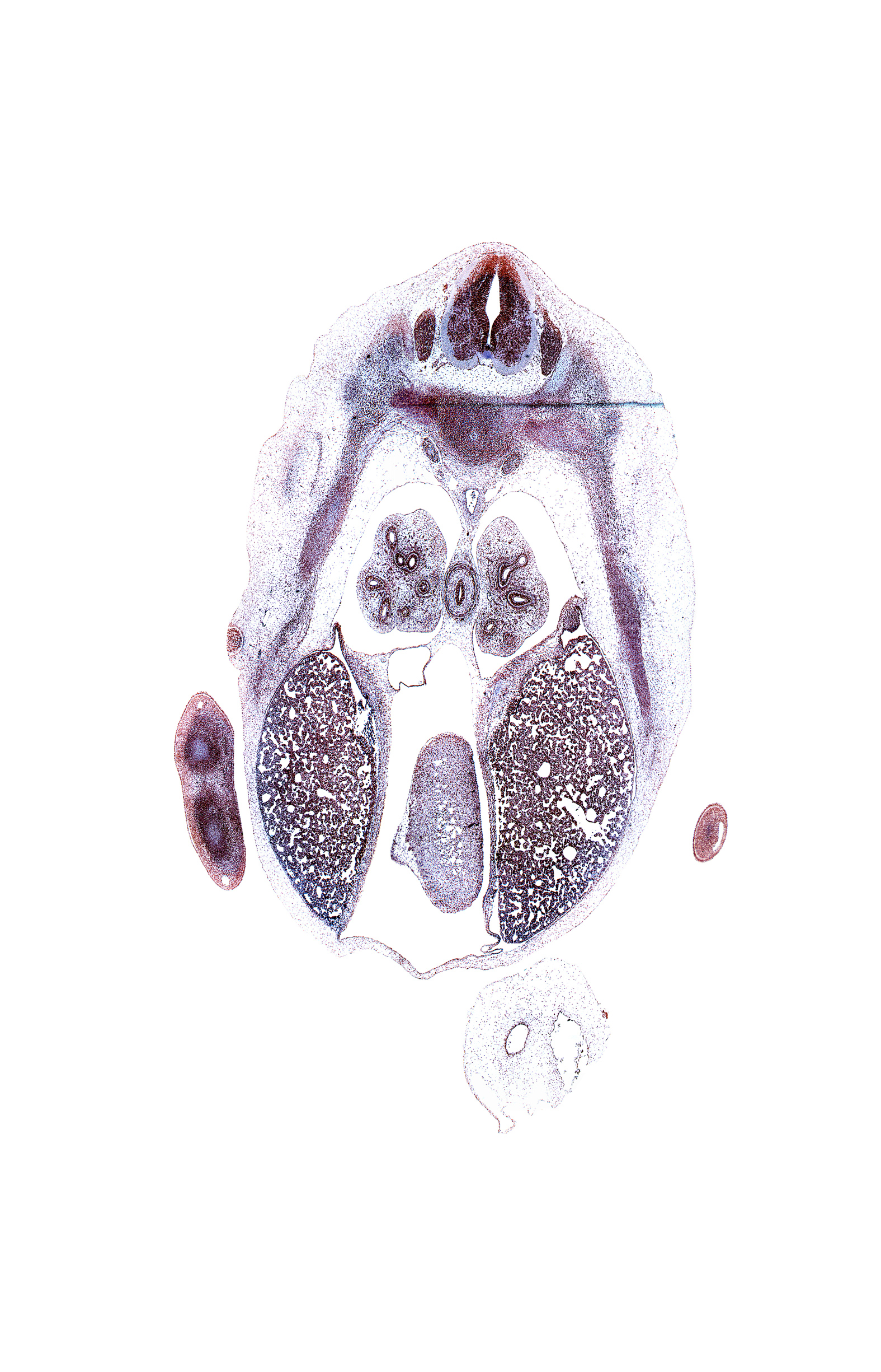 T-6 spinal ganglion, aorta, central tendon of diaphragm, iliocostalis muscle, inferior vena cava, left lobe of liver, left ventricle, longissimus muscle, lower lobe of left lung, lower lobe of right lung, mammary gland, marginal vein, mesonephros, metacarpal cartilage, pericardial cavity, rib 7, right lobe of liver, spinalis muscle, subarachnoid space, sympathetic trunk