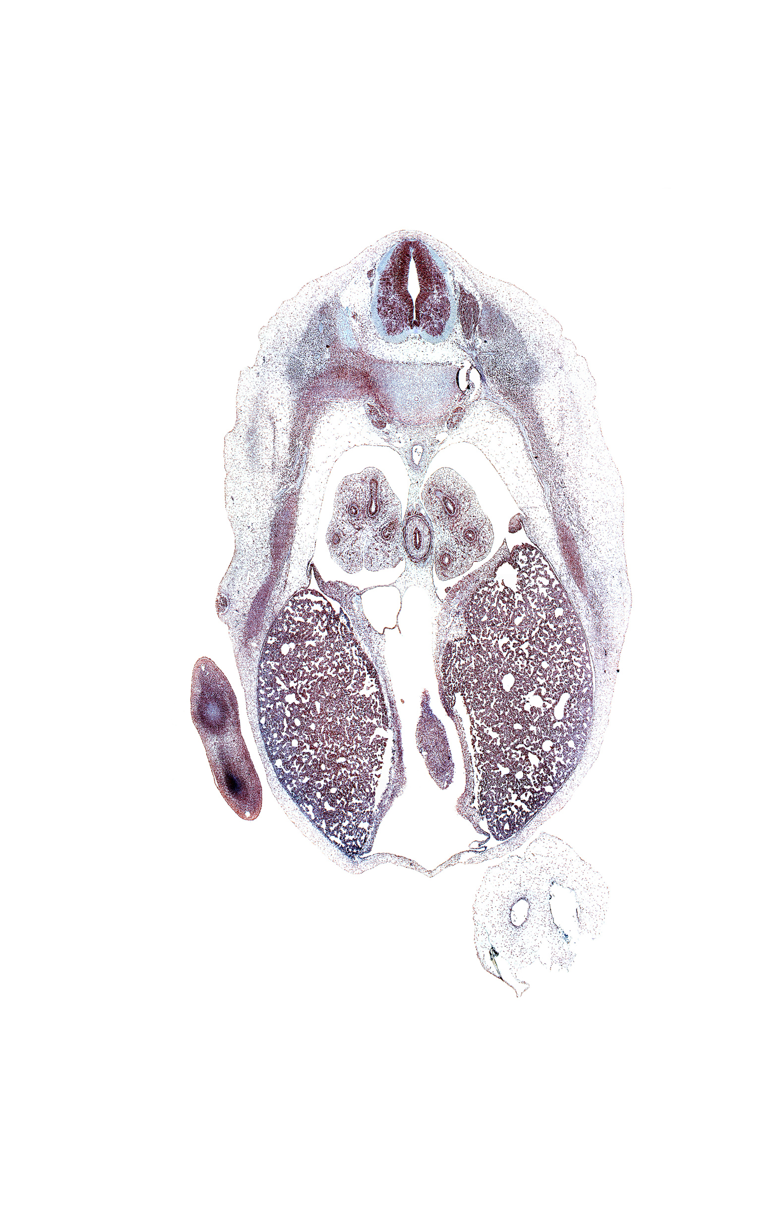 T-6 intercostal nerve, T-6 spinal ganglion, T-6 spinal nerve, caudal edge of left ventricle, central tendon of diaphragm, hand plate, iliocostalis muscle, inferior vena cava, left lobe of liver, longissimus muscle, lower lobe of right lung, mammary gland, neural arch, pericardial cavity, peritoneal cavity, pleural cavity, pleuropericardial membrane, pleuroperitoneal foramen, rib 7, right lobe of liver, spinalis muscle, subarachnoid space, sympathetic trunk