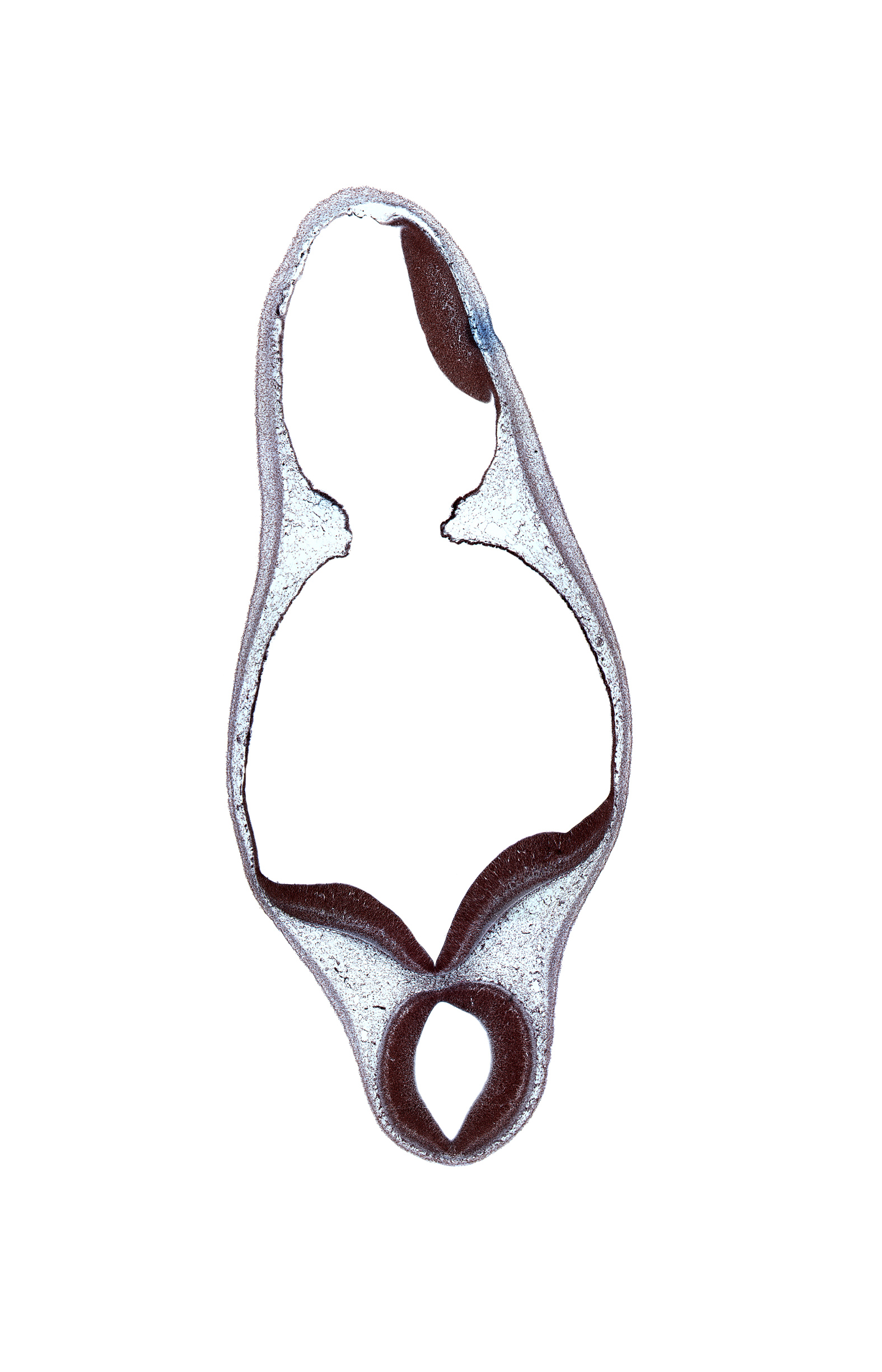 alar plate of mesencephalon, alar plate of metencephalon, alar plate of myelencephalon, cerebral aqueduct (mesocoele), diverticulum of rhombencoel (fourth ventricle), rhombencoel (fourth ventricle), roof of rhombencoel (fourth ventricle)