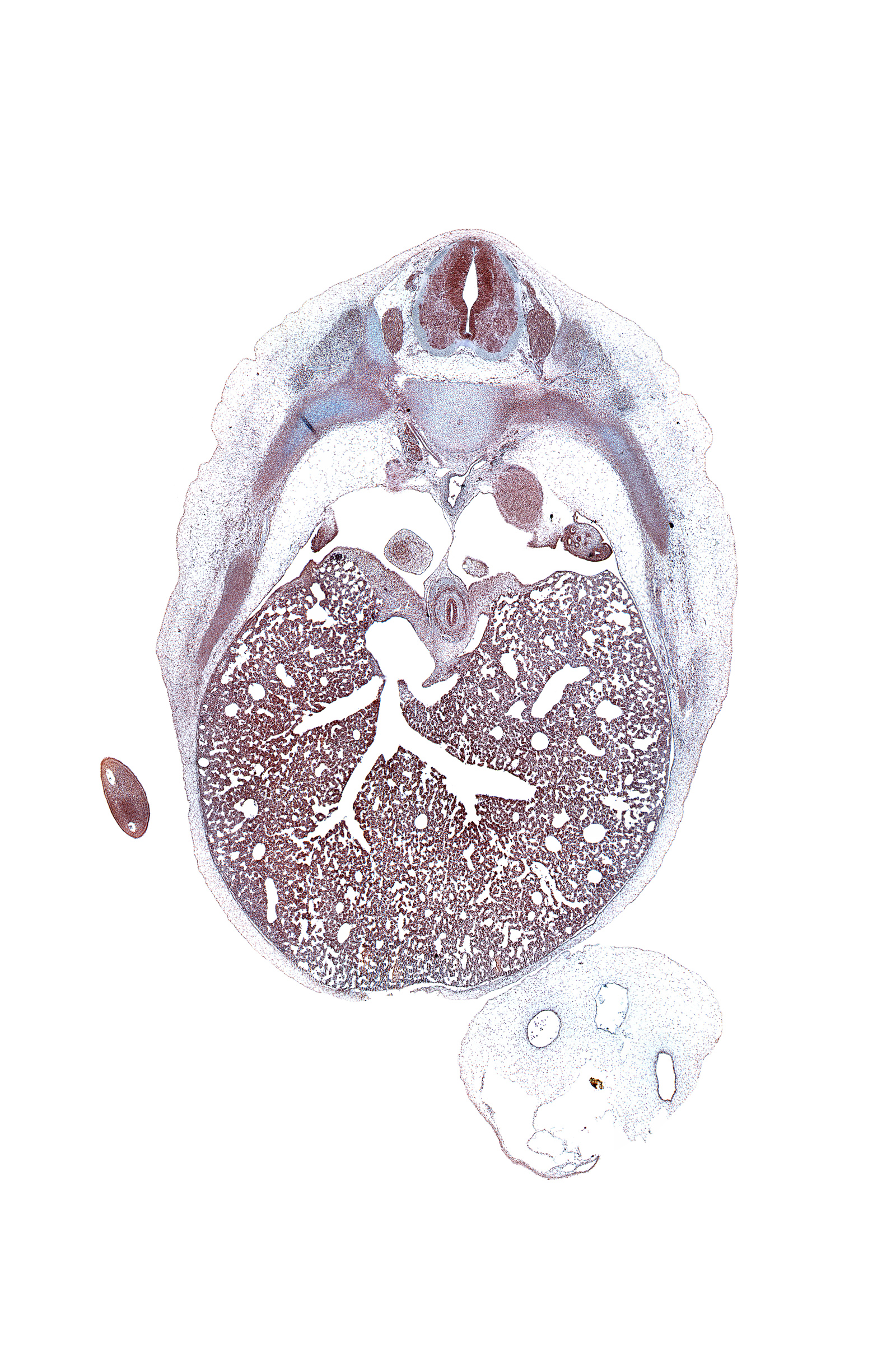 T-7 dorsal root, T-7 spinal ganglion, anterior gastric nerve (CN X), artifact(s), caudal edge of lower lobe of left lung, cephalic edge of suprarenal gland cortex, efferent hepatic vein, esophagus muscularis, greater splanchnic nerve, hand plate, inferior vena cava, left lobe of liver, liver prominence, lower lobe of right lung, marginal vein, osteogenic layer, pleural cavity, pleuroperitoneal foramen, posterior gastric nerve (CN X), posterior intercostal artery, rib 8, right lobe of liver, sympathetic trunk