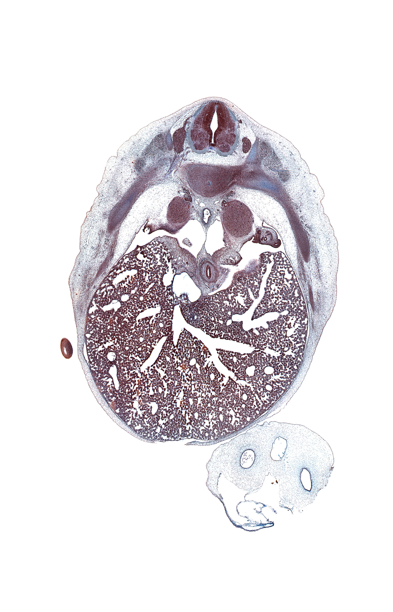 T-7 spinal ganglion, aorta, artifact(s), azygos vein, caudal edge of hand plate, caudal edge of lower lobe of right lung, cephalic edge of suprarenal gland cortex, dorsal meso-esophagus, efferent hepatic vein, efferent hepatic veins, esophagus, inferior hemi-azygos vein, left lobe of liver, left pleural cavity, mesonephric duct, mesonephros, pleuroperitoneal foramen, rib 8, right lobe of liver, subarachnoid space, tip of rib 9