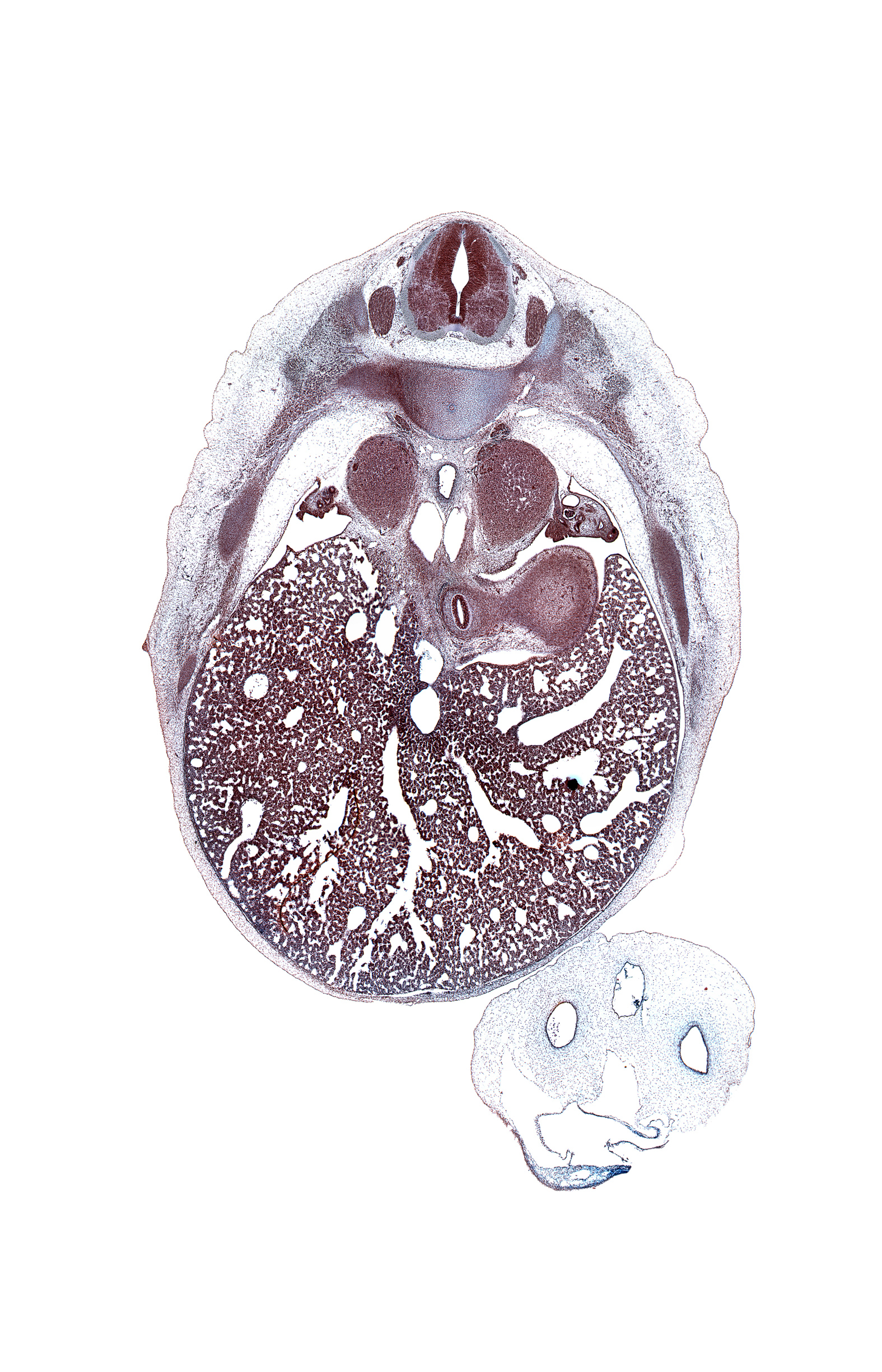 T-8 spinal ganglion, anterior gastric nerve (CN X), aorta, central canal, cephalic edge of gonad, ductus venosus, edge of fundus of stomach, efferent hepatic vein, efferent hepatic veins, esophagus, greater splanchnic nerve, inferior vena cava, left lobe of liver, liver prominence, mesonephros, peritoneal cavity, posterior gastric nerve (CN X), rib 9, right lobe of liver, right pleural cavity, sympathetic trunk
