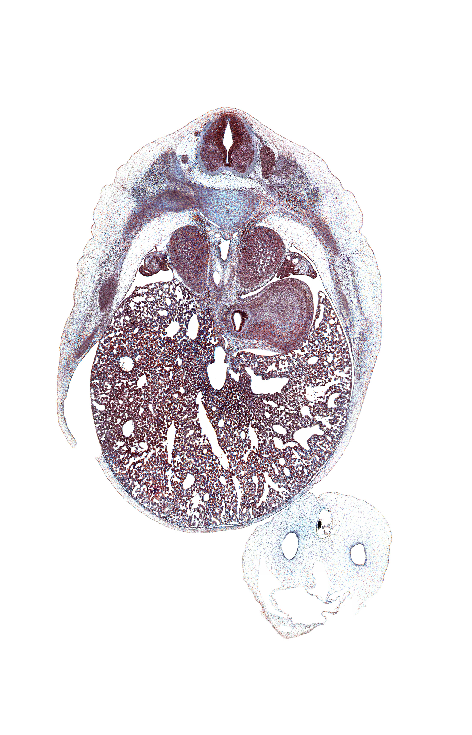 T-8 spinal ganglion, T-8 spinal nerve, aorta, artifact(s), caudal edge of left pleural cavity, caudal edge of right pleural cavity, ductus venosus, esophagus, fundus of stomach, iliocostalis muscle, inferior vena cava, left crus of diaphragm, left lobe of liver, left umbilical artery, liver prominence, longissimus muscle, neural arch, posterior intercostal artery, rib 9, right lobe of liver, right umbilical artery, spinalis muscle, sympathetic trunk, umbilical vein