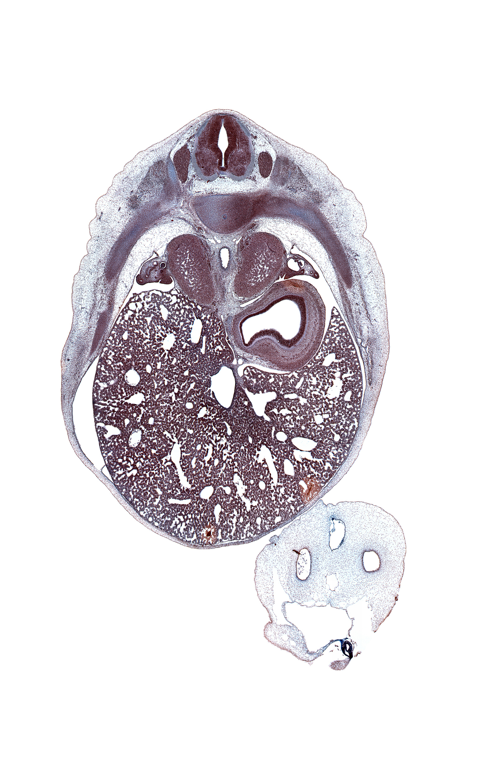 T-8 / T-9 intervertebral disc, T-8 spinal ganglion, aorta, artifact space(s), artifact(s), azygos vein, caudal edge of esophagus, central canal, ductus venosus, inferior vena cava (hepatic part), intermediate zone, junction of esophagus and stomach, left lobe of liver, left umbilical artery, lumen of fundus of stomach, marginal zone, mesonephric duct, omphalomesenteric vessels, rib 9, right umbilical artery, suprarenal gland cortex, umbilical coelom, umbilical vein, ventricular zone