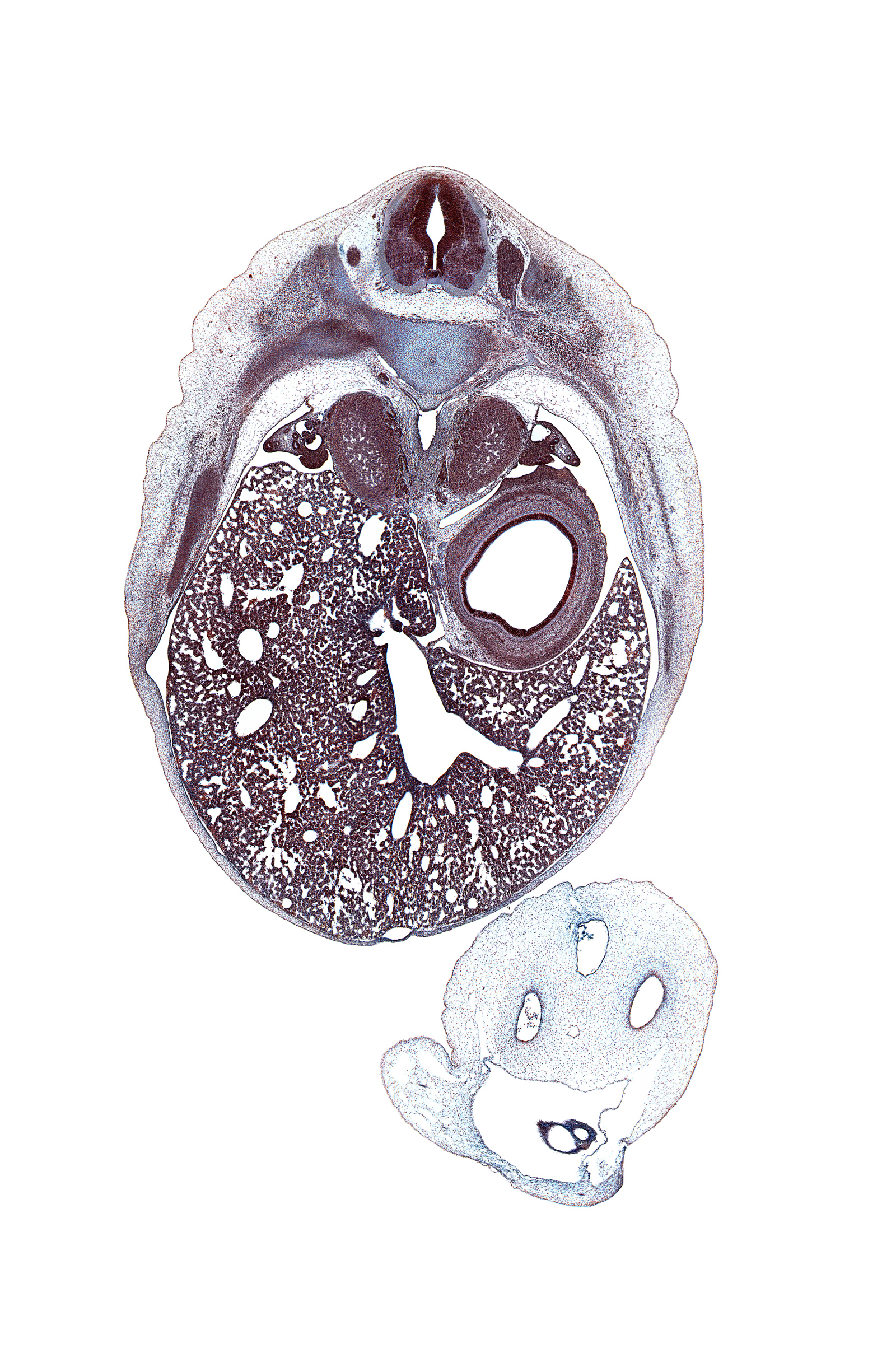 T-9 spinal ganglion, allantois, amnion on surface of umbilical cord, aorta, ductus venosus, gonad, greater splanchnic nerve, hepatic portal vein, inferior vena cava, left lobe of liver, left umbilical artery, lumen of body of stomach, omphalomesenteric vessels, posterior intercostal artery, rib 10, right lobe of liver, right umbilical artery, suprarenal gland cortex, sympathetic trunk, umbilical coelom, umbilical vein