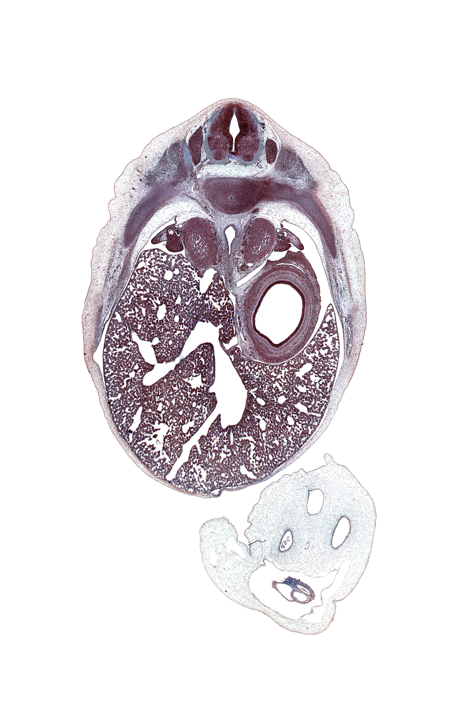 T-9 / T-10 intervertebral disc, T-9 spinal ganglion, allantois, aorta, caudate lobe of liver, celiac artery, dorsal mesogastrium, ductus venosus, efferent hepatic veins, gonad, hepatic portal vein, inferior vena cava, left umbilical artery, lumen of body of stomach, mesonephros, omphalomesenteric vessels, peritoneal cavity, rectus abdominis muscle, rib 10, right umbilical artery, spleen, suprarenal gland cortex, umbilical coelom, umbilical vein