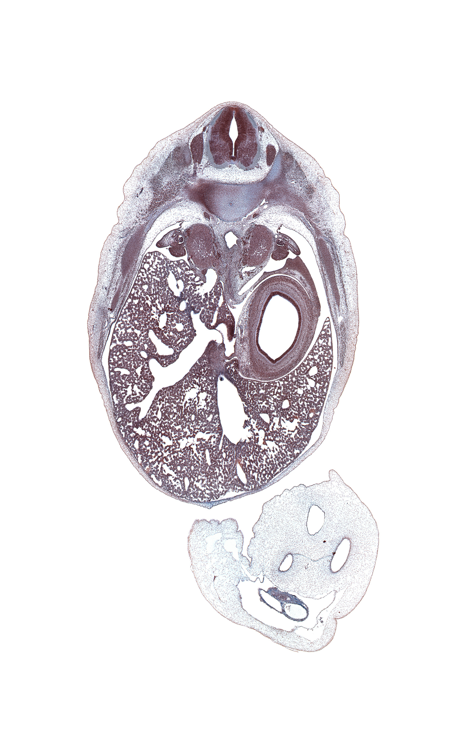 T-10 spinal ganglion, aorta, azygos vein, central canal, dorsal mesogastrium, ductus venosus, efferent hepatic vein, epiploic foramen, gonad, hepatic portal vein, inferior vena cava (hepatic part), left lobe of liver, left umbilical artery, liver prominence, omphalomesenteric vessels, rib 10, right lobe of liver, right umbilical artery, spleen, subarachnoid space, suprarenal gland medulla, sympathetic trunk, umbilical coelom, umbilical vein