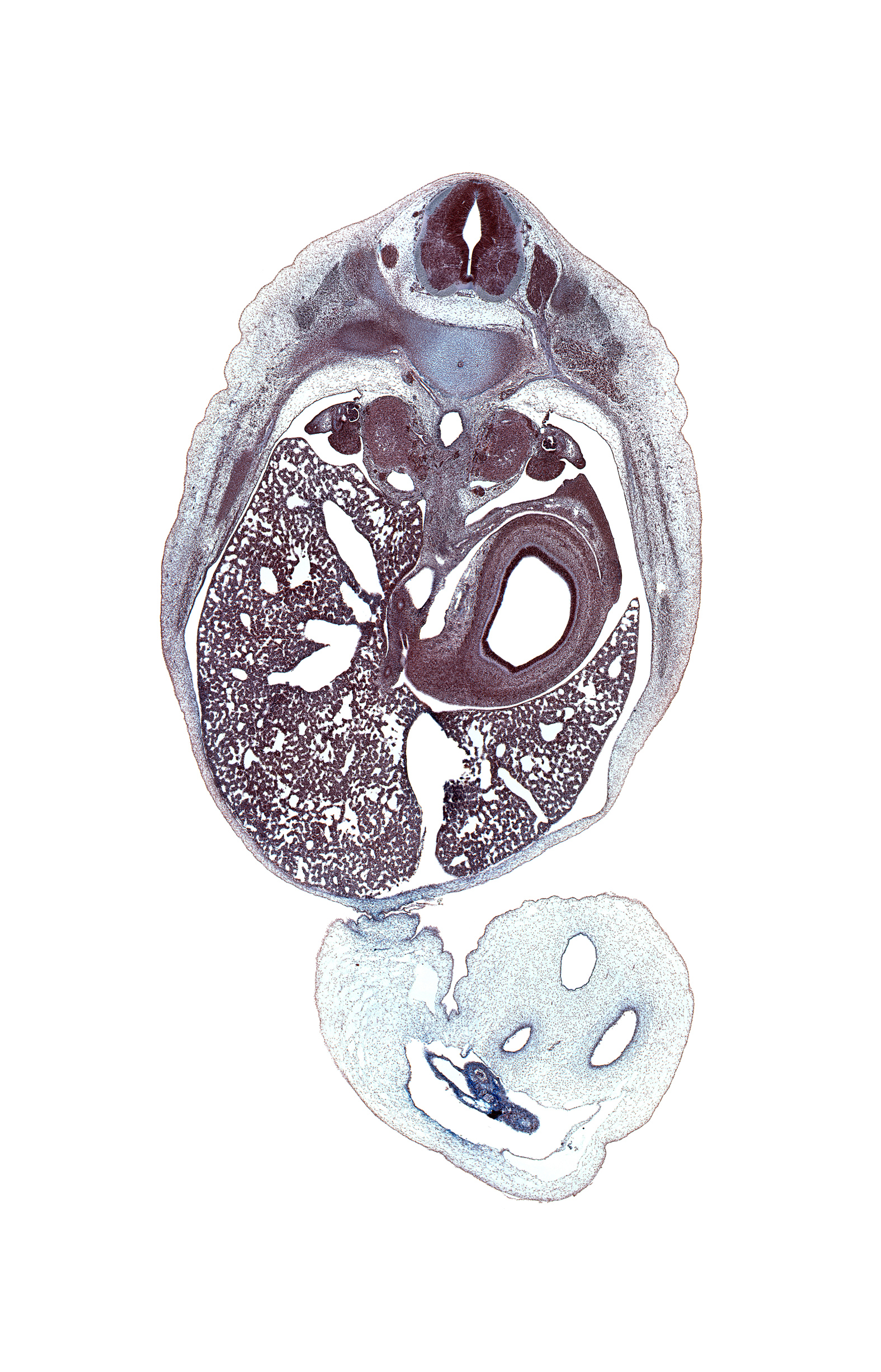 T-10 dorsal primay ramus, T-10 intercostal nerve, T-10 spinal ganglion, T-10 spinal nerve, T-10 ventral primary ramus, afferent hepatic vein, allantois, aorta, body of pancreas, common hepatic duct, dorsal mesogastrium, ductus venosus, hepatic portal vein, inferior vena cava, junction of anterior abdominal wall and umbilical cord, left lobe of liver, left subcardinal vein, left umbilical artery, lesser  sac, lumen of body of stomach, notochord, omphalomesenteric vessels, rectus abdominis muscle, right lobe of liver, right umbilical artery, spleen, superior mesenteric ganglion, suprarenal gland cortex, sympathetic trunk, umbilical coelom, umbilical vein