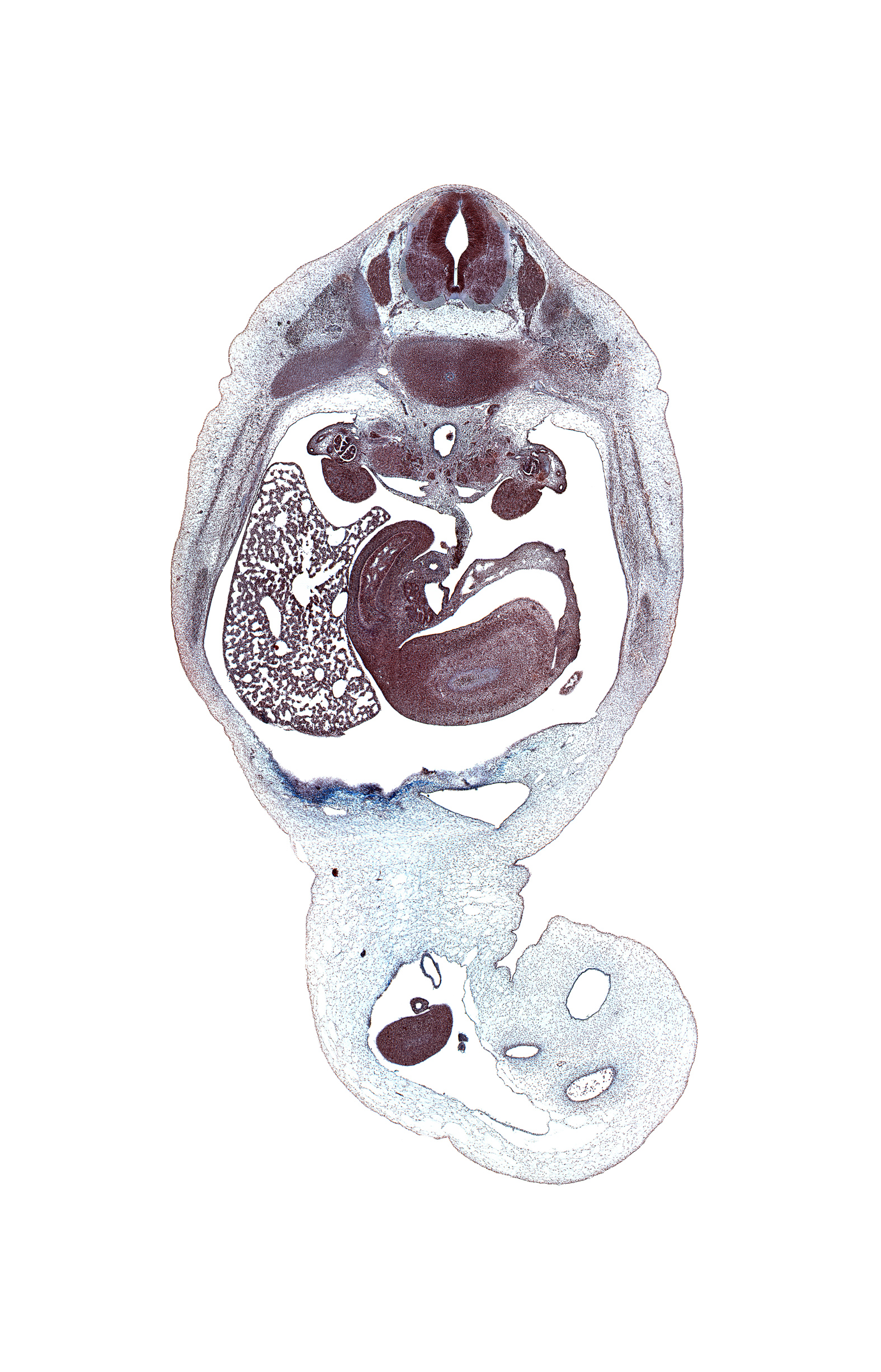 T-11 / T-12 intervertebral disc, T-11 spinal ganglion, allantois, aorta, caudal edge of left lobe of liver, duodenum (second part), gonad, head of pancreas, hepatic portal vein, inferior vena cava, kidney (metanephros), latissimus dorsi muscle, left subcardinal vein, left umbilical artery, lesser  sac, mesonephric duct, mesonephros, midpoint of midgut, neural arch, omphalomesenteric vessels, right lobe of liver, right umbilical artery, splenic vein, subarachnoid space, superior mesenteric artery, umbilical coelom, umbilical vein, wall of stomach