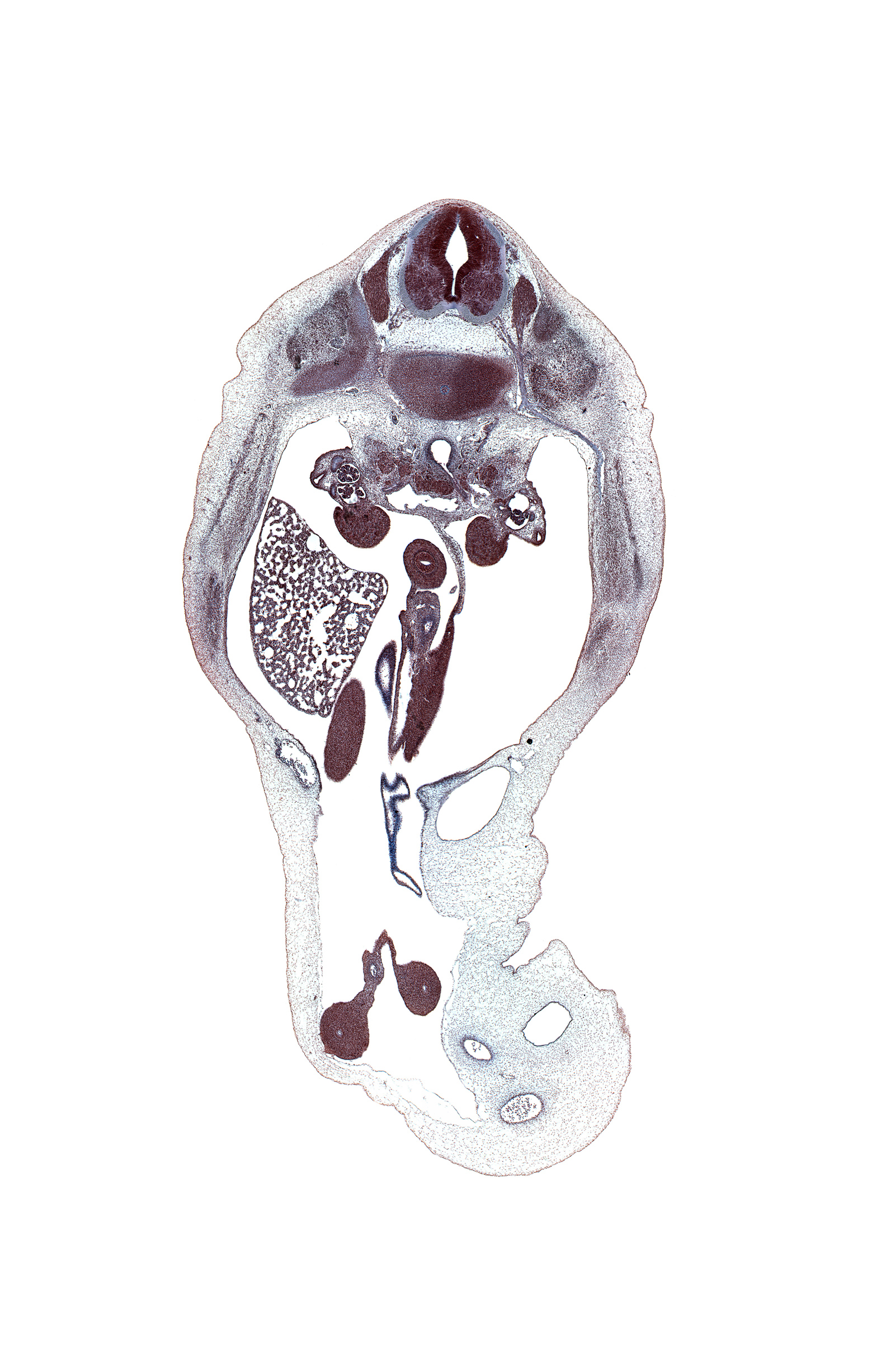 T-12 spinal ganglion, T-12 spinal nerve, allantois, aorta, central canal, cephalic edge of duodenum, distal limb of herniated midgut, duodenum, external abdominal oblique muscle, gonad, iliocostalis muscle, internal abdominal oblique muscle, kidney (metanephros), left umbilical artery, longissimus muscle, mesentery, mesonephric duct, neural arch, proximal limb of herniated midgut, rectus abdominis muscle, renal artery, right lobe of liver, right umbilical artery, spinalis muscle, subcostal nerve (T-12), superior mesenteric artery, superior mesenteric vein, transversus abdominis muscle, umbilical coelom, umbilical vein