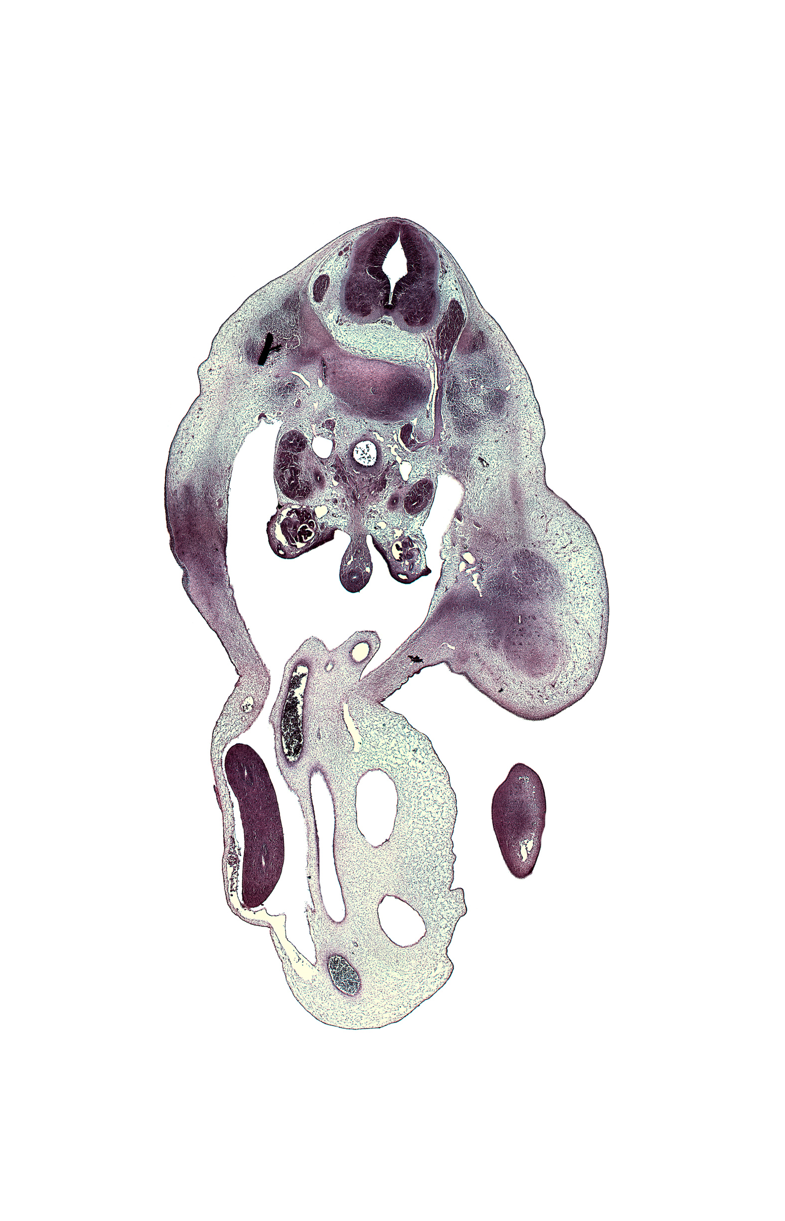 L-2 / L-3 intervertebral disc, L-2 spinal ganglion, L-2 ventral primary ramus, allantois, aorta, communicating ramus, femoral artery, foot plate, gubernaculum of gonad, hindgut endoderm, inferior pole of left kidney (metanephros), inferior vena cava, junction of allantois and urinary bladder, kidney (metanephros), left umbilical artery, neural arch, osteogenic layer, proximal limb of herniated midgut, right umbilical artery, subarachnoid space, sympathetic trunk, thigh, umbilical coelom, umbilical vein, ureter