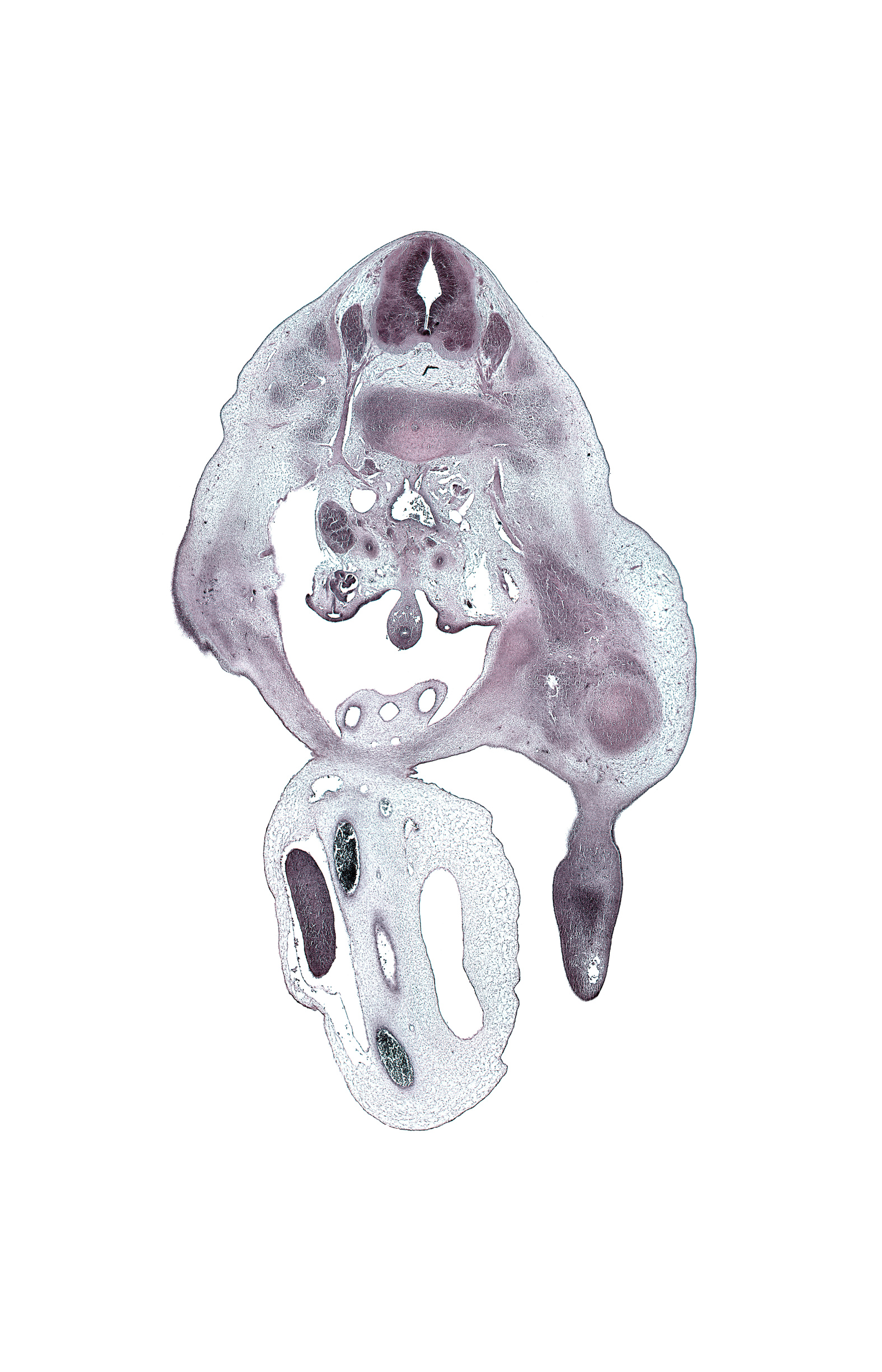 L-2 spinal ganglion, L-2 spinal nerve, allantois, aortic bifurcation, blastemata of anterior thigh muscles, dorsal root(s), dorsum of foot plate, edge of left umbilical artery, edge of proximal limb of herniated midgut, external iliac vessels, head of femur, hindgut, inferior pole of right kidney (metanephros), inferior vena cava, left umbilical artery, lumbar plexus, marginal vein, mesonephric duct, right umbilical artery, sympathetic trunk, umbilical coelom, umbilical vein, ureter, urinary bladder, ventral root