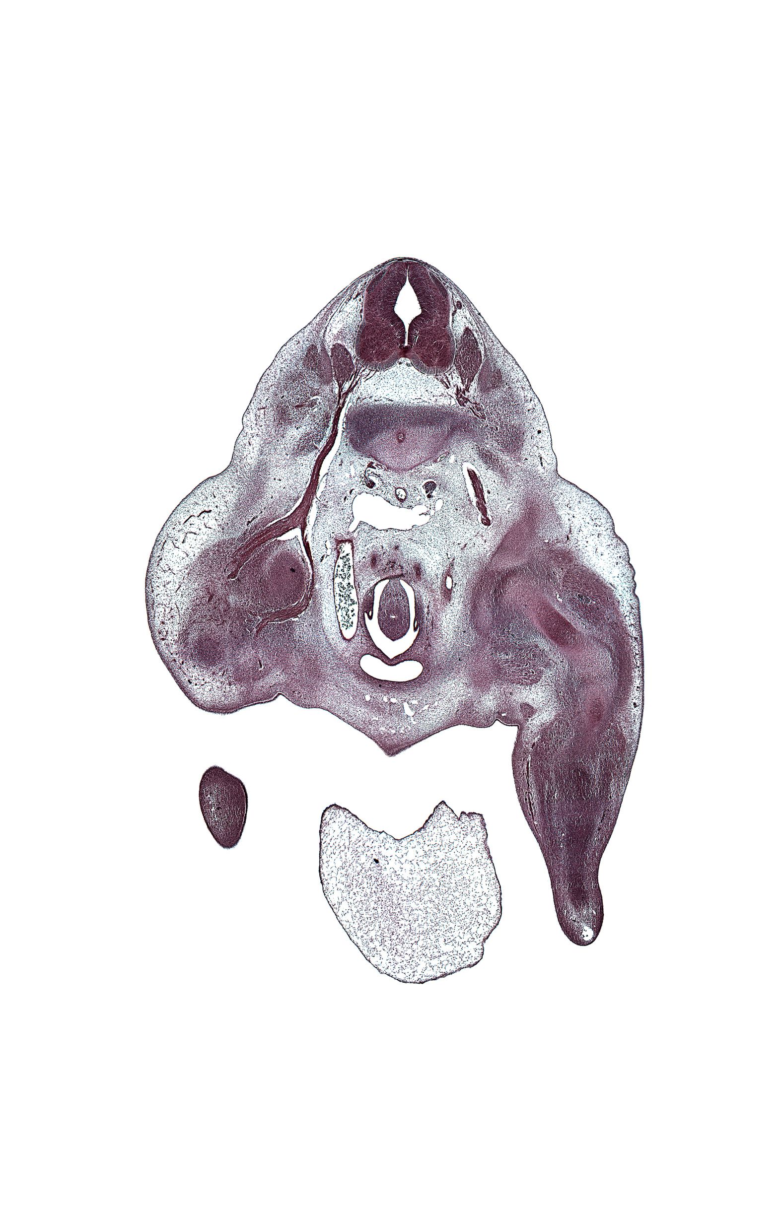 L-3 / L-4 intervertebral disc, L-3 spinal ganglion, L-3 spinal nerve, L-4 ventral primary ramus, central canal, cephalic edge of lower limb, cephalic edge of phallus, femur, gubernaculum of gonad, hindgut, hip joint, ilium, inferior vena cava, internal iliac artery, ischium, labioscrotal swelling, median sacral artery, mesonephric duct, neural arch, notochord, osteogenic layer, peritoneal cavity, sympathetic trunk, umbilical cord, ureter, urinary bladder