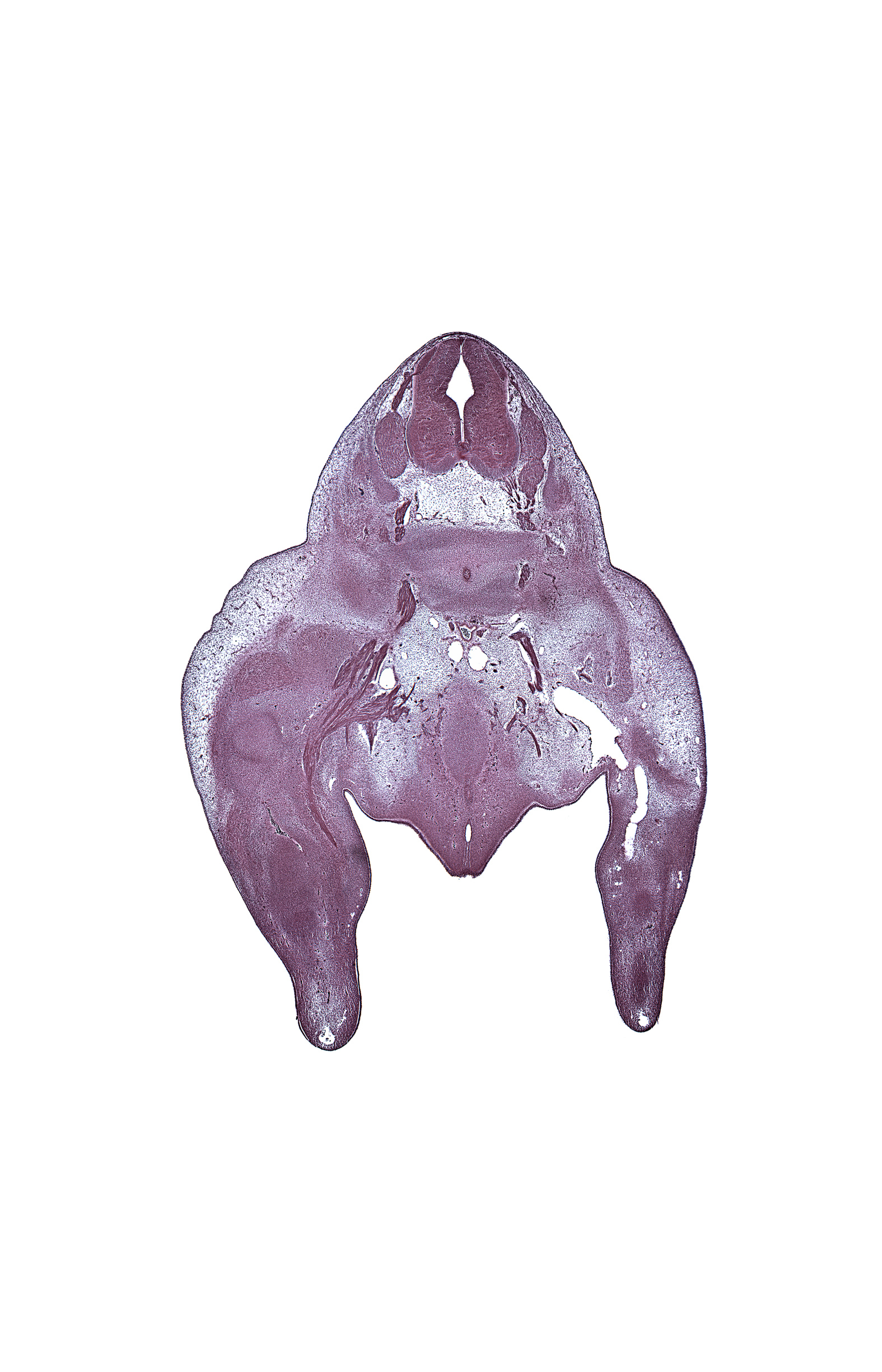 L-5 spinal ganglion, S-1 / S-2 intervertebral region, S-1 spinal ganglion, S-1 spinal nerve, S-2 ventral primary ramus, S-3 ventral primary ramus, dorsal root(s), edge of rectum, intermediate zone, knee joint, labioscrotal swelling, left common iliac artery, marginal vein, pelvic plexus, sciatic nerve, subarachnoid space, sympathetic trunk, tibial nerve, urethra, urethral fold, urethral plate, urorectal septum, ventricular zone