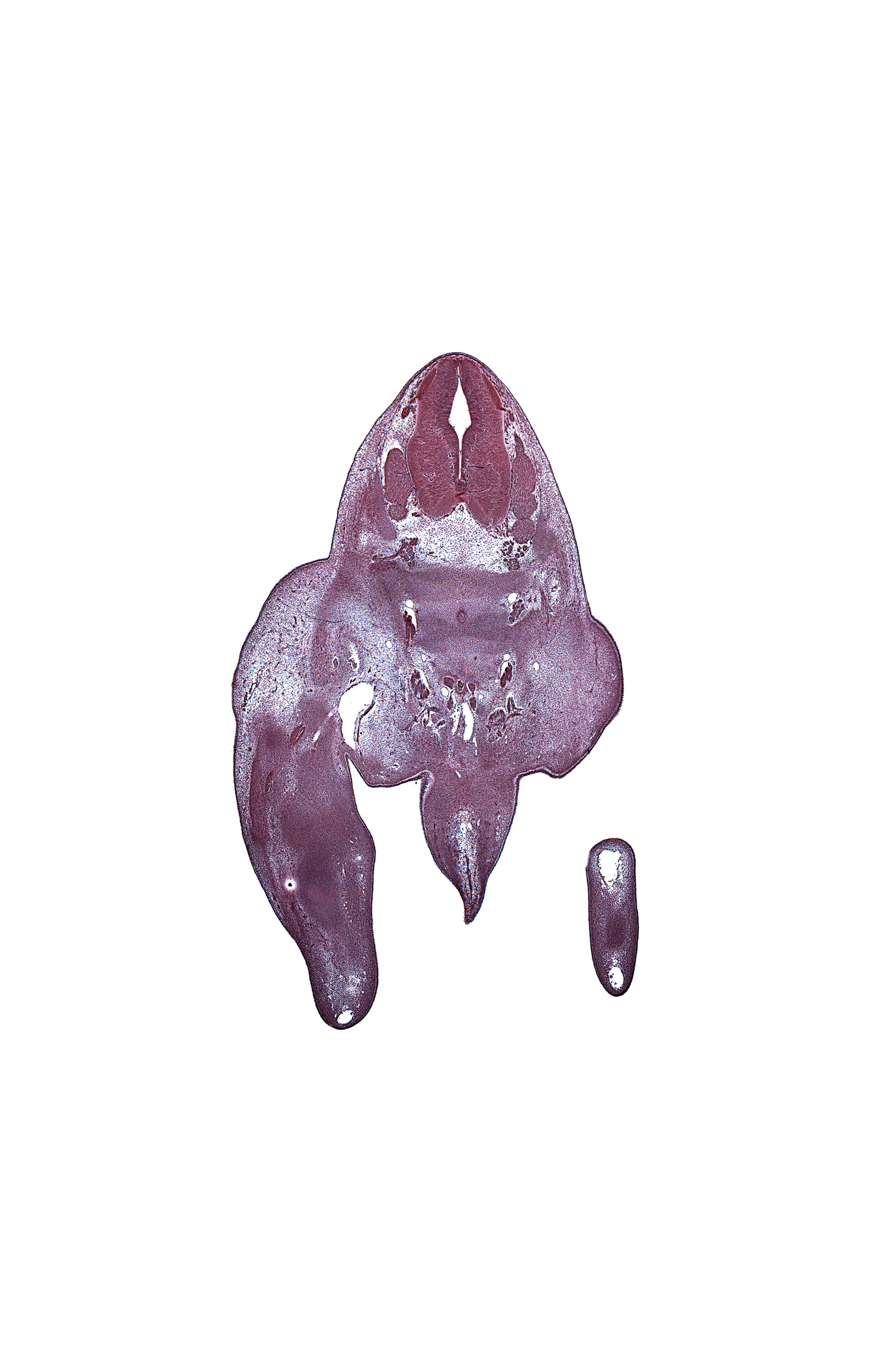 S-1 spinal ganglion, S-2 spinal ganglion, S-2 spinal nerve, S-3 / S-4 intervertebral region, S-3 ventral primary ramus, S-4 ventral primary ramus, alar plate(s), basal plate, caudal eminence, coccygeal plexus, dorsum of foot plate, floor plate, gluteal region, internal iliac vein, labioscrotal swelling, marginal vein, metatarsal condensation, notochord, roof plate, sulcus limitans, sympathetic trunk, tarsal condensation(s)