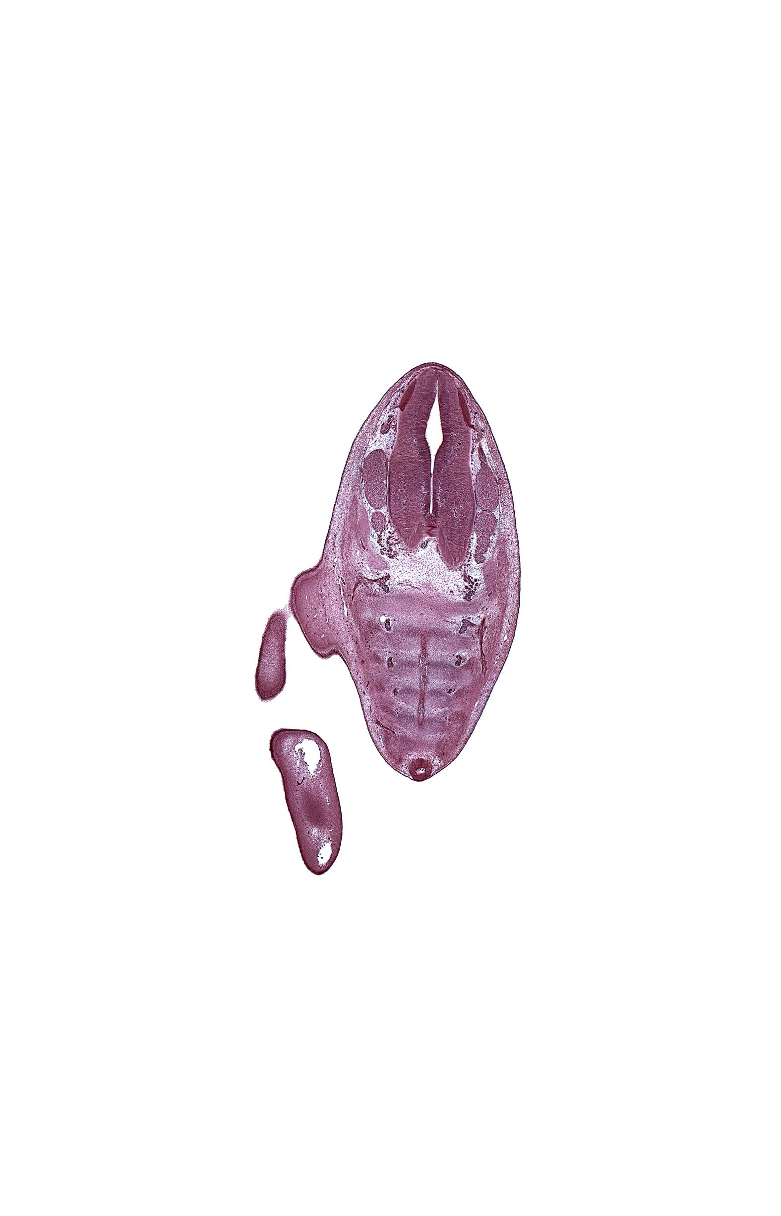 Co-1 ventral primary ramus, Co-2 ventral primary ramus, S-1 dorsal root, S-1 spinal ganglion, S-2 spinal ganglion, S-3 spinal nerve, S-4 ventral primary ramus, S-5 ventral primary ramus, alar plate(s), basal plate, caudal eminence, coccyx, decussation in floor plate, filum terminale, gluteal region, marginal vein, neural arch, notochord, roof plate, sulcus limitans, ventricle of central canal
