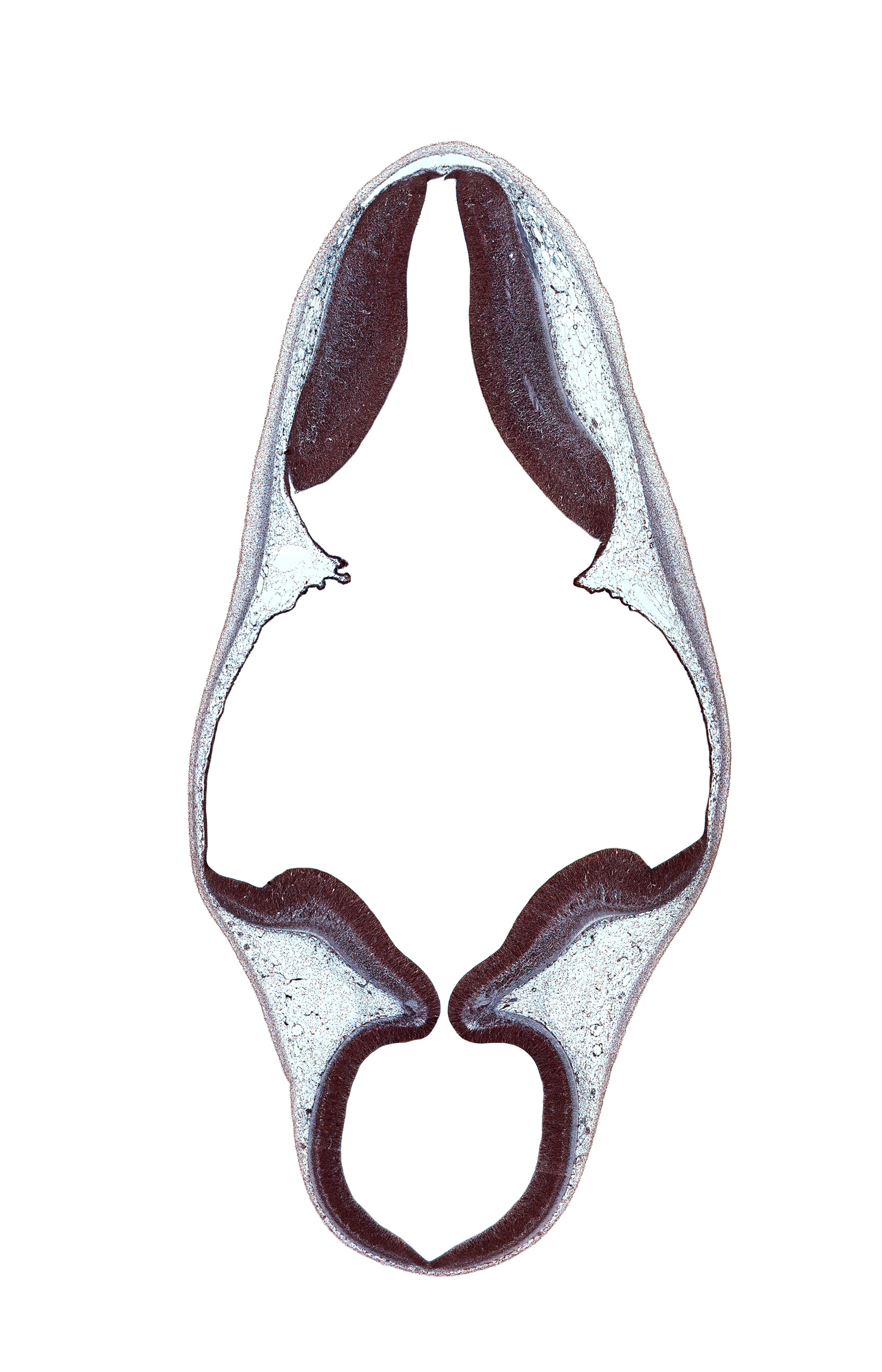 alar plate of myelencephalon, cerebral aqueduct (mesocoele), isthmus of rhombencephalon, myelencephalon, rhombencoel (fourth ventricle), roof of rhombencoel (fourth ventricle), roof plate, subarachnoid space, trochlear nerve (CN IV)