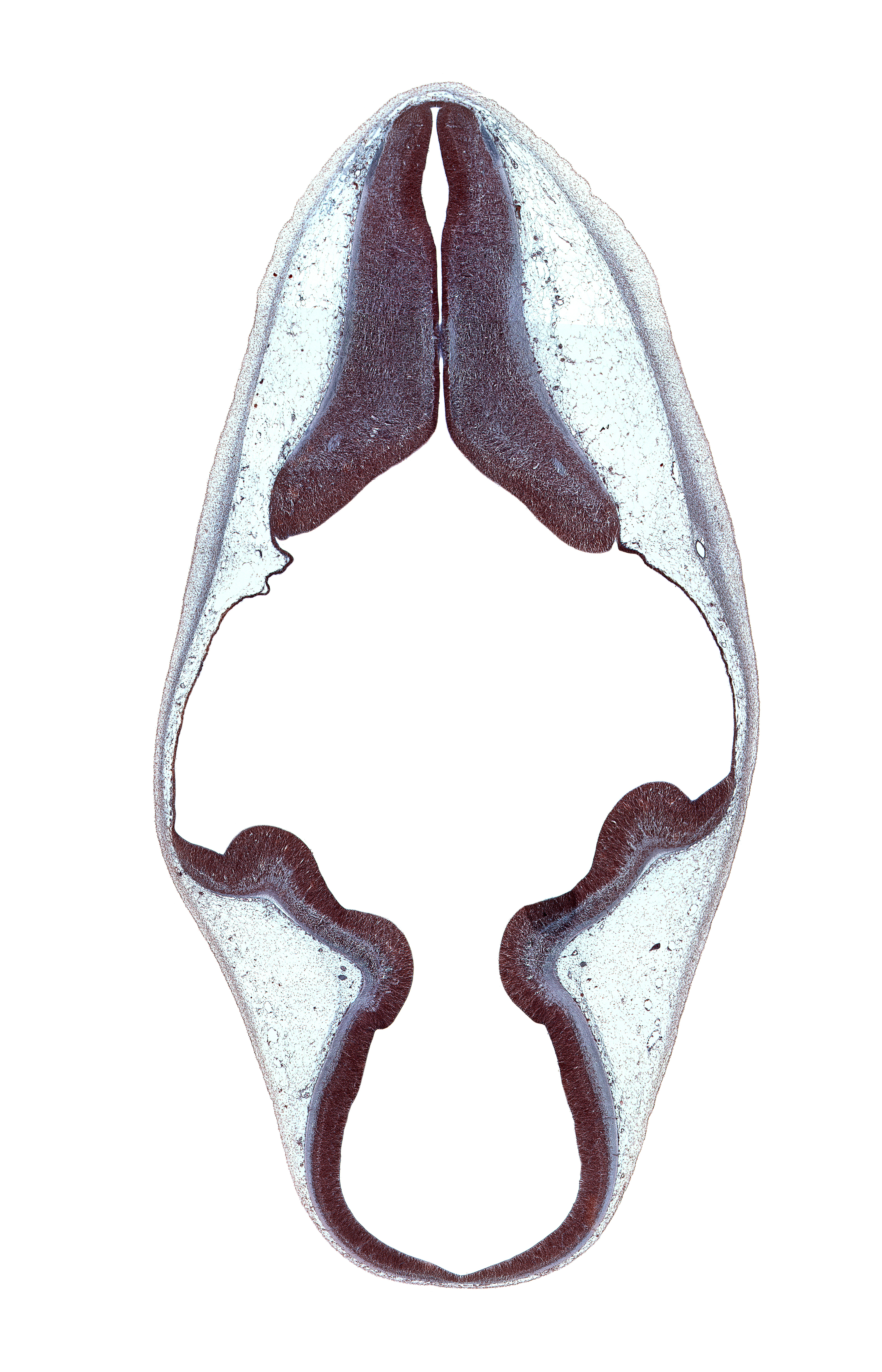 alar plate(s), basal plate, cerebral aqueduct (mesocoele), endolymphatic duct, isthmus of rhombencephalon, obex, rhombencoel (fourth ventricle), roof plate, sulcus limitans, trochlear nerve (CN IV)