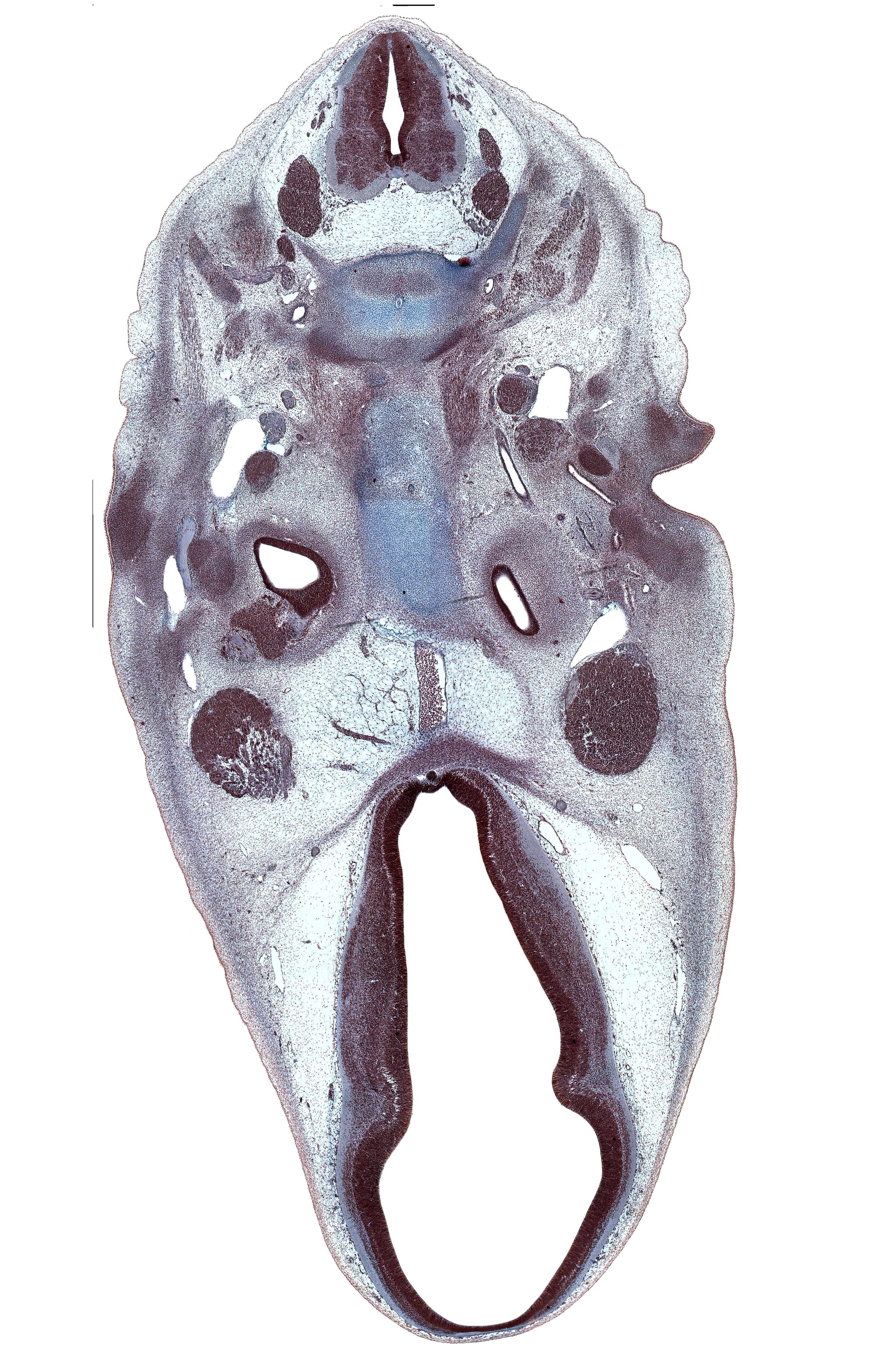 C-2 / C-3 intervertebral disc, C-3 spinal ganglion, C-3 spinal nerve, C-4 spinal ganglion, abducens nerve (CN VI), basi-occipital (basal plate), basilar artery, caudal edge of cochlear duct, centrum of C-2 vertebra (axis), centrum of C-3 vertebra, dorsal thalamus, edge of neurohypophysis, hypothalamus, inferior ganglion of glossopharyngeal nerve (CN IX), internal carotid artery, motor root of trigeminal nerve (CN V), neural arch of C-3 vertebra, notochord, posterior communicating artery, semispinalis capitis muscle, semispinalis cervicis muscle, stapedial artery, stapes condensation, subarachnoid space, ventral thalamus, vertebral artery, zona limitans intrathalamica