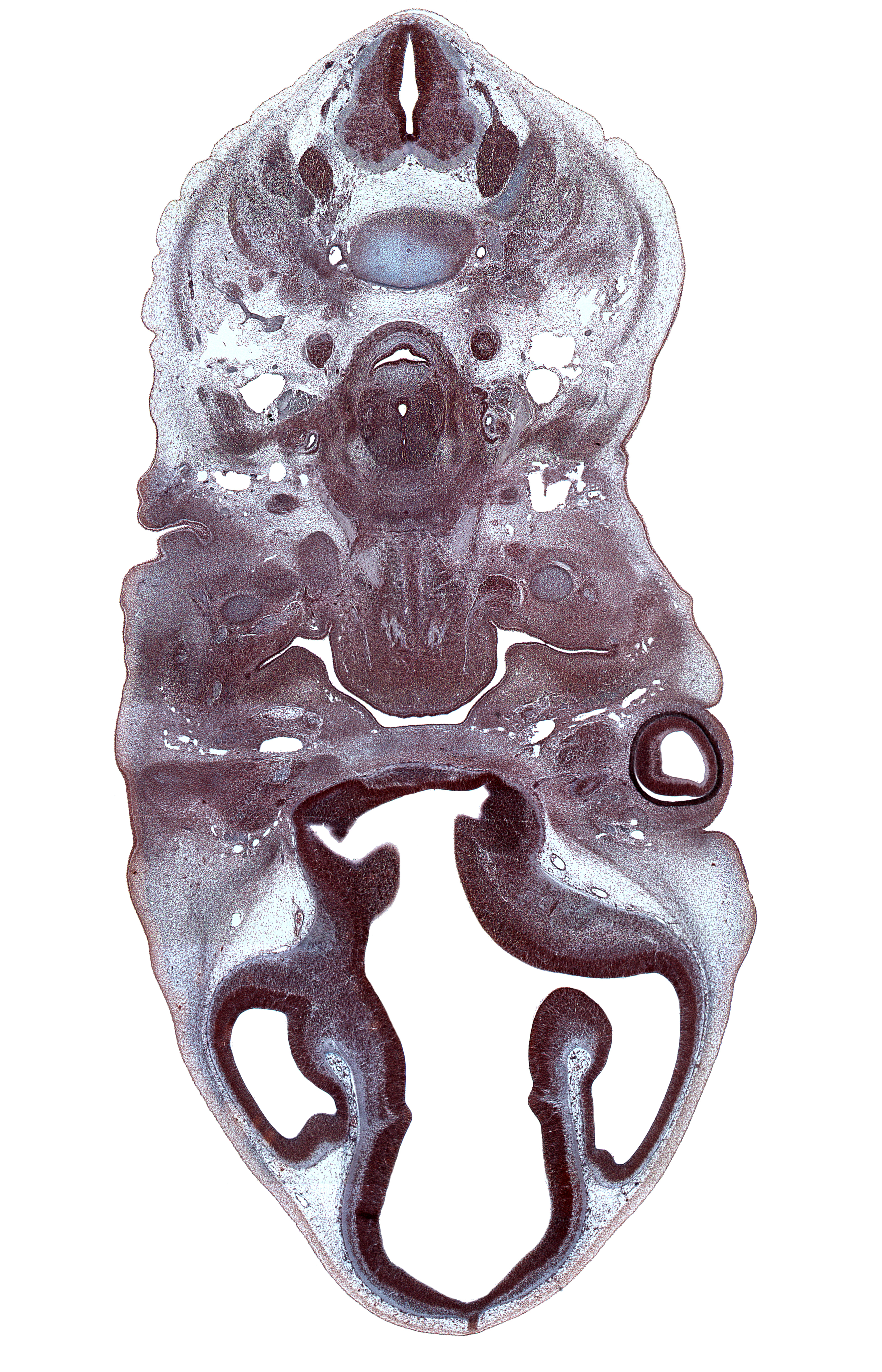 C-4 / C-5 intervertebral disc, C-5 spinal nerve, C-6 dorsal root, C-6 spinal ganglion, centrum of C-4 vertebra, cerebral vesicle (telencephalon), ciliary ganglion, cornea, dorsal thalamus, epithalamus, external acoustic meatus, fusion region between cerebral vesicle and diencephalon, hyoid body condensation, hypothalamus (diencephalon), inferior pharyngeal constrictor muscle, interventricular foramen, intraretinal space (optic vesicle cavity), jugular lymph sac, lateral ventricle, marginal ridge, maxillary venous plexus, ophthalmic nerve (CN V₁), optic cup cavity, optic nerve (CN II), optic ventricle, parotid gland bud, pineal bud, precardinal vein (internal jugular vein), splenius muscle, submandibular ganglion, submandibular gland bud, trapezius muscle, ventral thalamus (diencephalon)