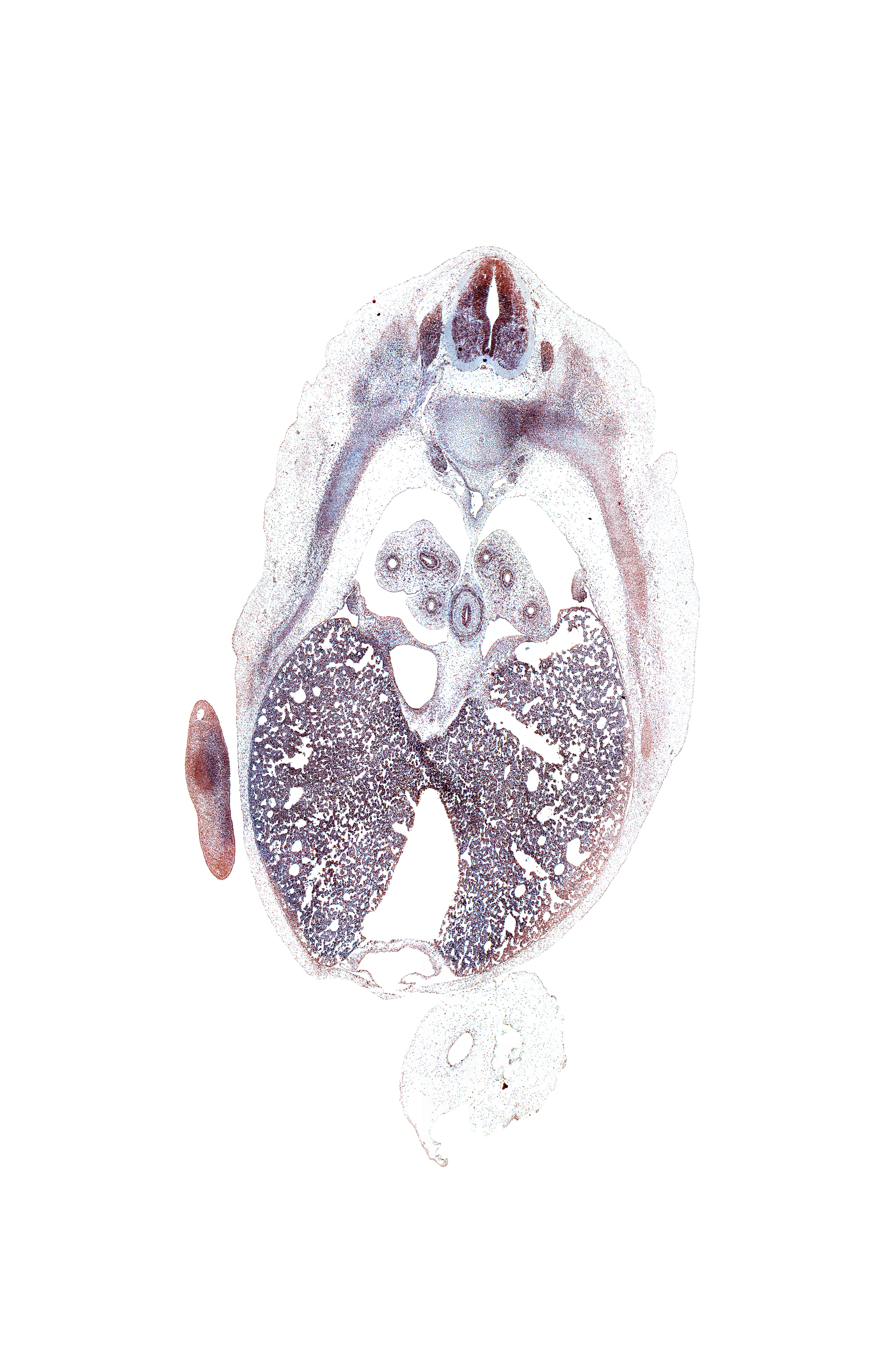 T-7 spinal ganglion, costovertebral joint, inferior vena cava, left lobe of liver, lower lobe of left lung, lower lobe of right lung, pericardial cavity, peritoneal cavity, pleuroperitoneal foramen, pulmonary ligament, rib 8, right lobe of liver, sympathetic trunk