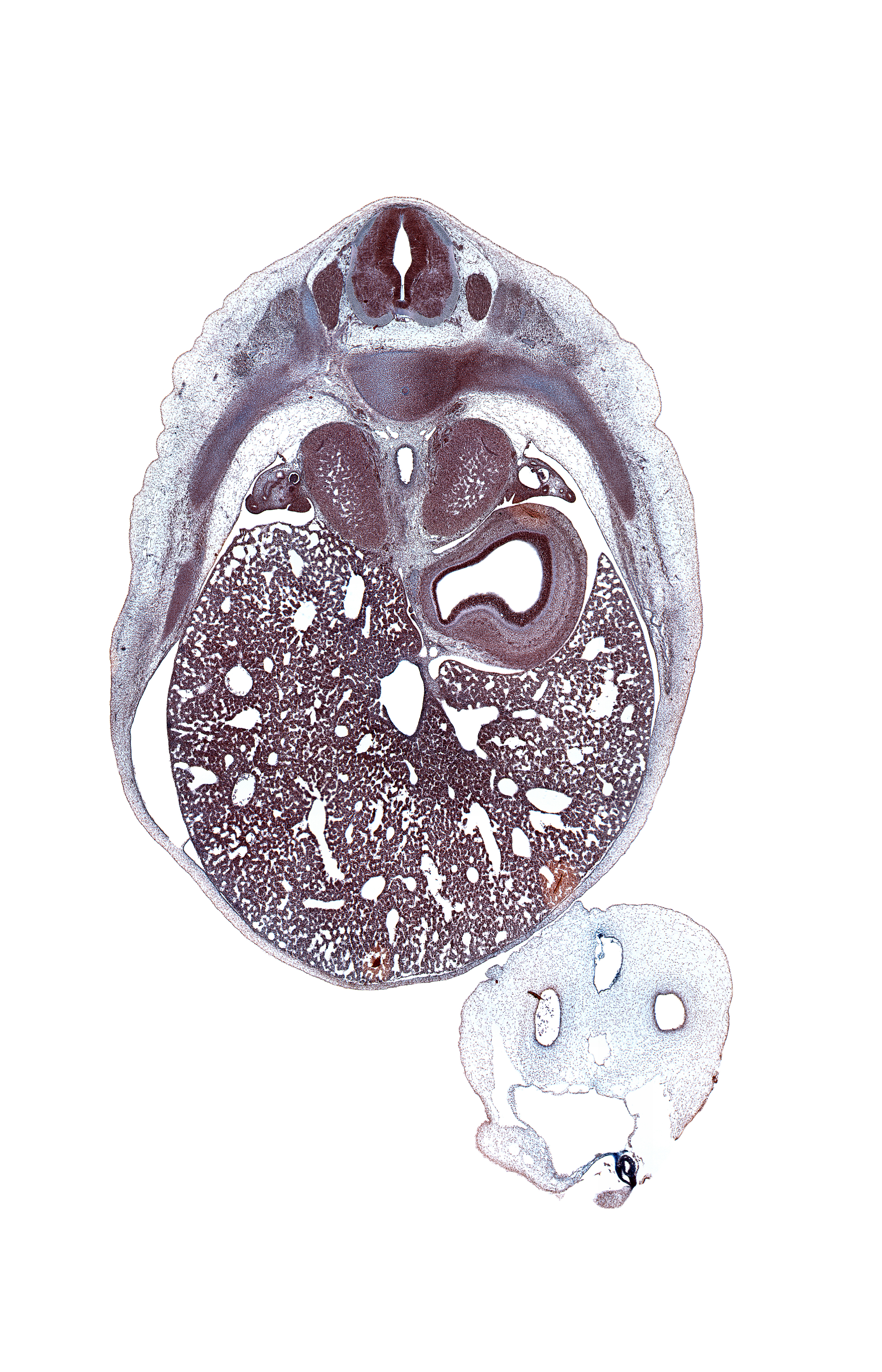T-8 / T-9 intervertebral disc, T-8 spinal ganglion, aorta, artifact space(s), artifact(s), azygos vein, caudal edge of esophagus, central canal, ductus venosus, inferior vena cava (hepatic part), intermediate zone, junction of esophagus and stomach, left lobe of liver, left umbilical artery, lumen of fundus of stomach, marginal zone, mesonephric duct, omphalomesenteric vessels, rib 9, right umbilical artery, suprarenal gland cortex, umbilical coelom, umbilical vein, ventricular zone
