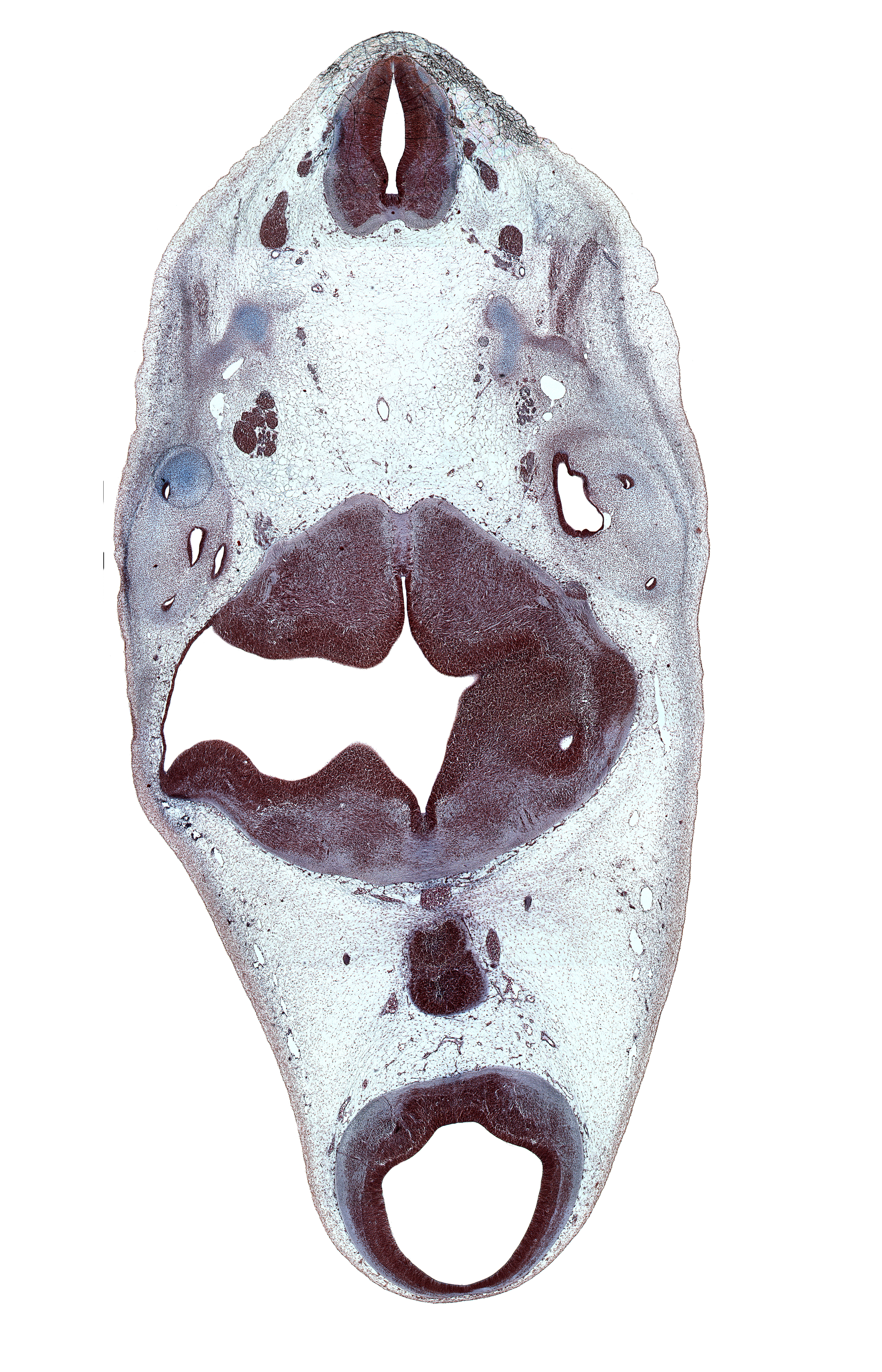 C-1 spinal ganglion, C-2 spinal ganglion, alar plate(s), basal plate, basilar artery, central canal, cerebral aqueduct (mesocoele), decussation, edge of diencephalon, lateral semicircular duct, left posterior cerebral artery, mesencephalon, metencephalon, myelencephalon, rhombencoel (fourth ventricle), right vertebral artery, root of glossopharyngeal nerve (CN IX), root of hypoglossal nerve (CN XII), root of vestibulocochlear nerve (CN VIII), subarachnoid space, sulcus limitans, tectum, tegmentum, vertebral artery