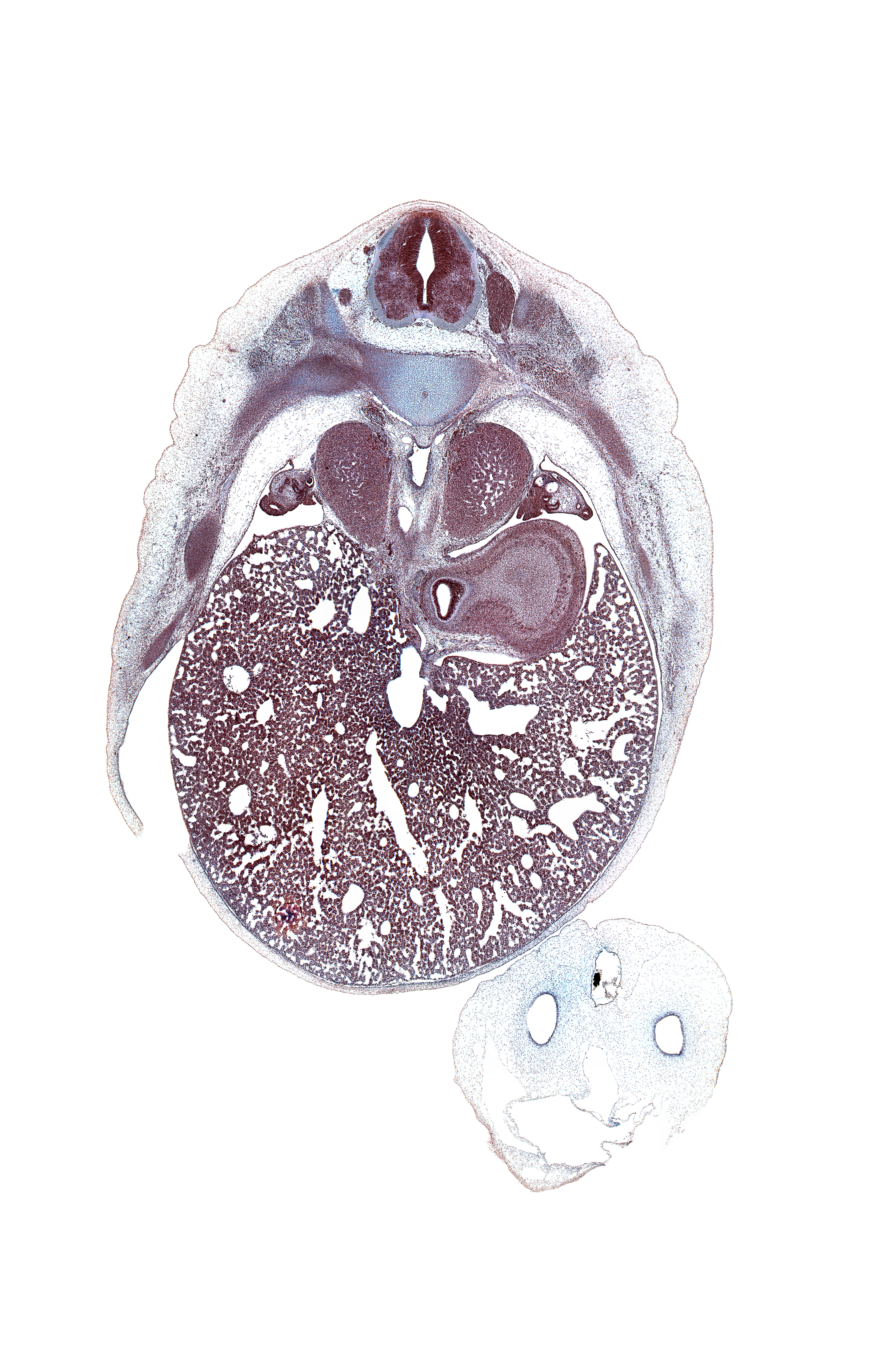 T-8 spinal ganglion, T-8 spinal nerve, aorta, artifact(s), caudal edge of left pleural cavity, caudal edge of right pleural cavity, ductus venosus, esophagus, fundus of stomach, iliocostalis muscle, inferior vena cava, left crus of diaphragm, left lobe of liver, left umbilical artery, liver prominence, longissimus muscle, neural arch, posterior intercostal artery, rib 9, right lobe of liver, right umbilical artery, spinalis muscle, sympathetic trunk, umbilical vein