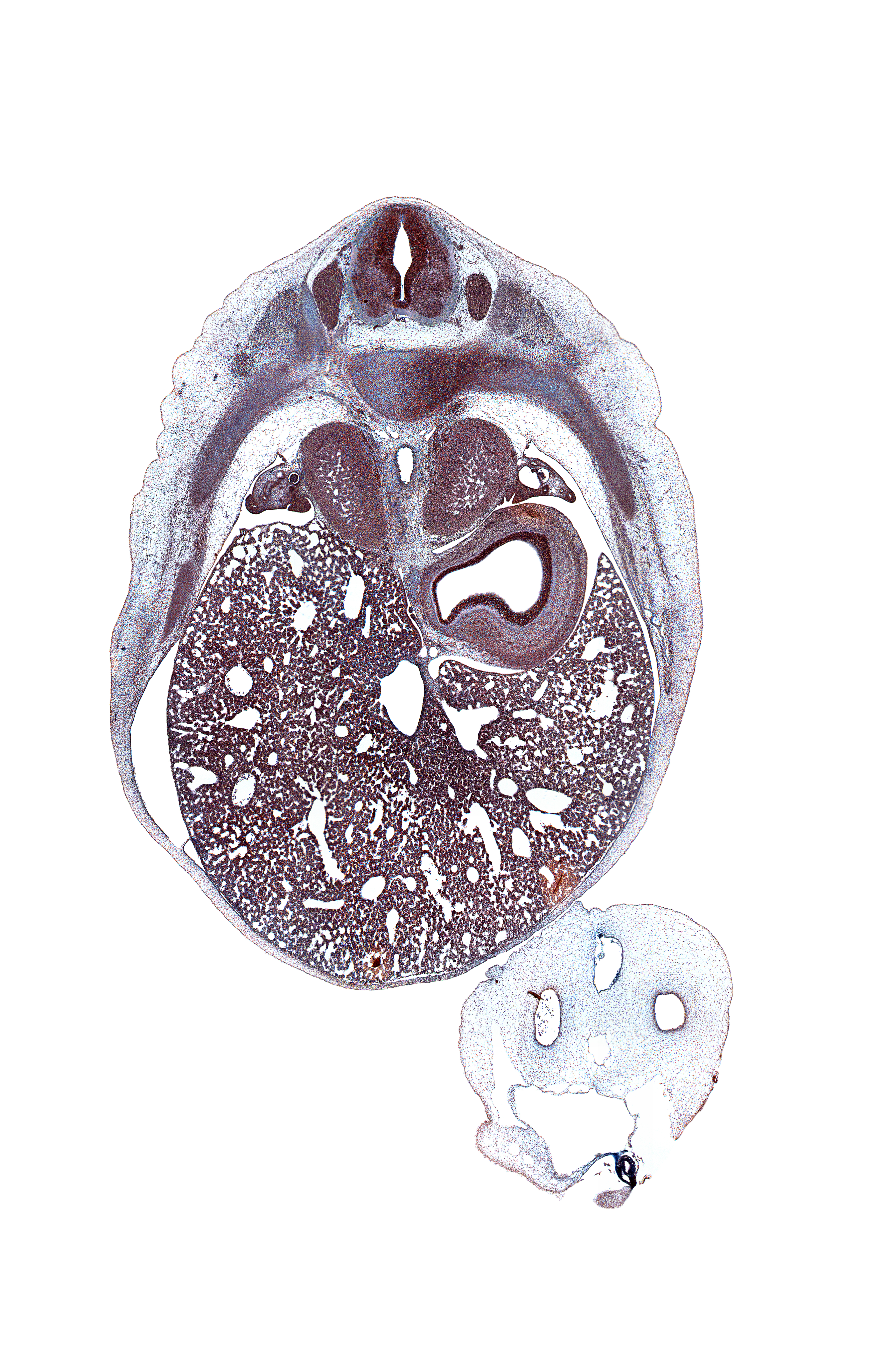 T-8 / T-9 intervertebral disc, T-8 spinal ganglion, aorta, artifact space(s), artifact(s), azygos vein, caudal edge of esophagus, central canal, ductus venosus, inferior vena cava (hepatic part), intermediate zone, junction of esophagus and stomach, left lobe of liver, left umbilical artery, lumen of fundus of stomach, marginal zone, mesonephric duct, omphalomesenteric vessels, rib 9, right umbilical artery, suprarenal gland cortex, umbilical coelom, umbilical vein, ventricular zone