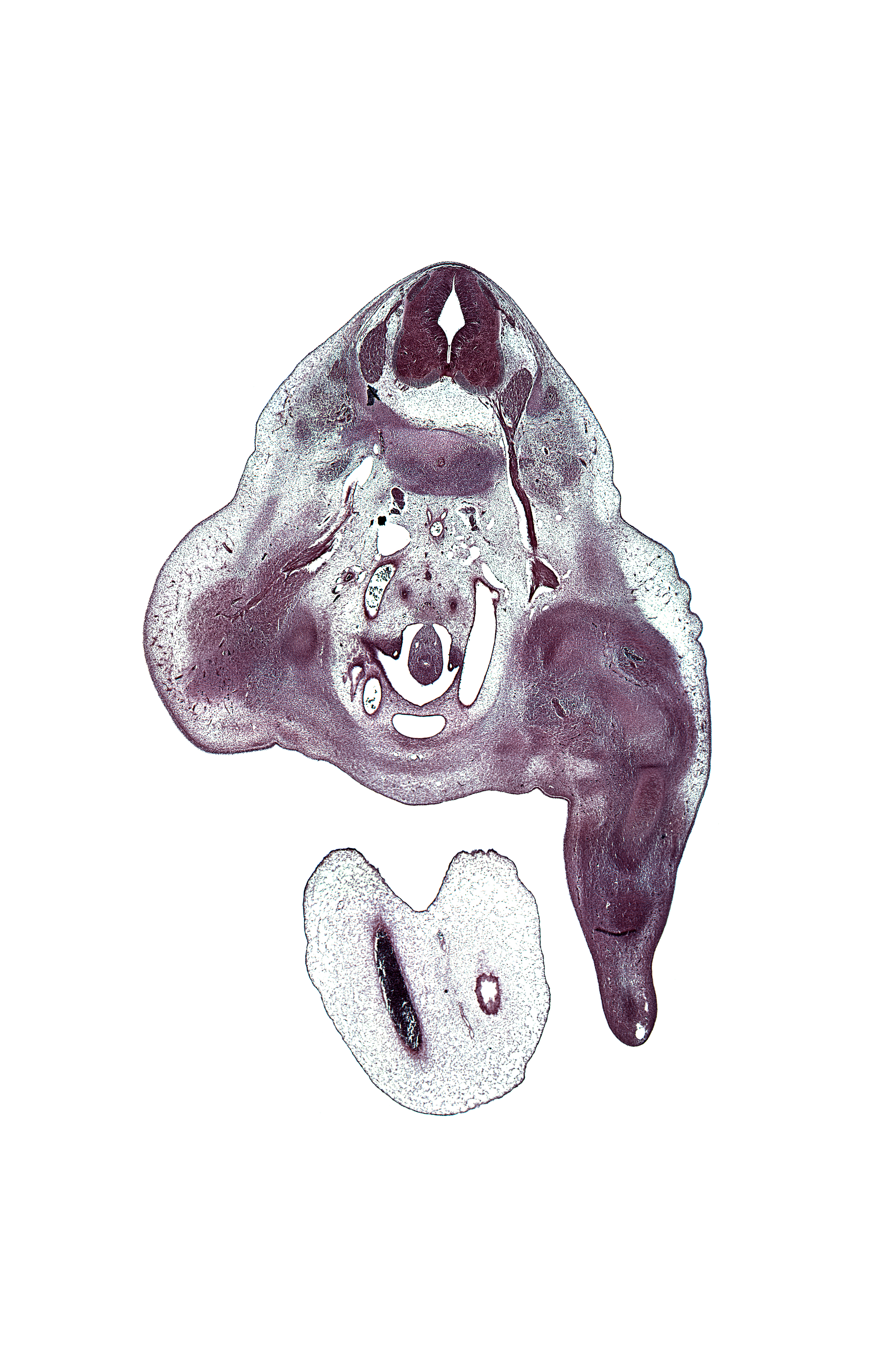 L-3 / L-4 intervertebral disc, L-3 spinal ganglion, L-3 ventral primary ramus, allantois, ankle region, blastemata of extensor muscles in leg, blastemata of flexor muscles in leg, dorsal root(s), edge of right umbilical artery, edge of umbilical vein, femur, hindgut, knee joint, left umbilical artery, lumbar plexus, median sacral artery, mesonephric duct, neural arch, origin of external iliac artery, osteogenic layer, pedicle, peritoneal cavity, plantar surface of foot plate, right common iliac artery, right umbilical artery, tibia, umbilical cord, ureter, urinary bladder, ventral root